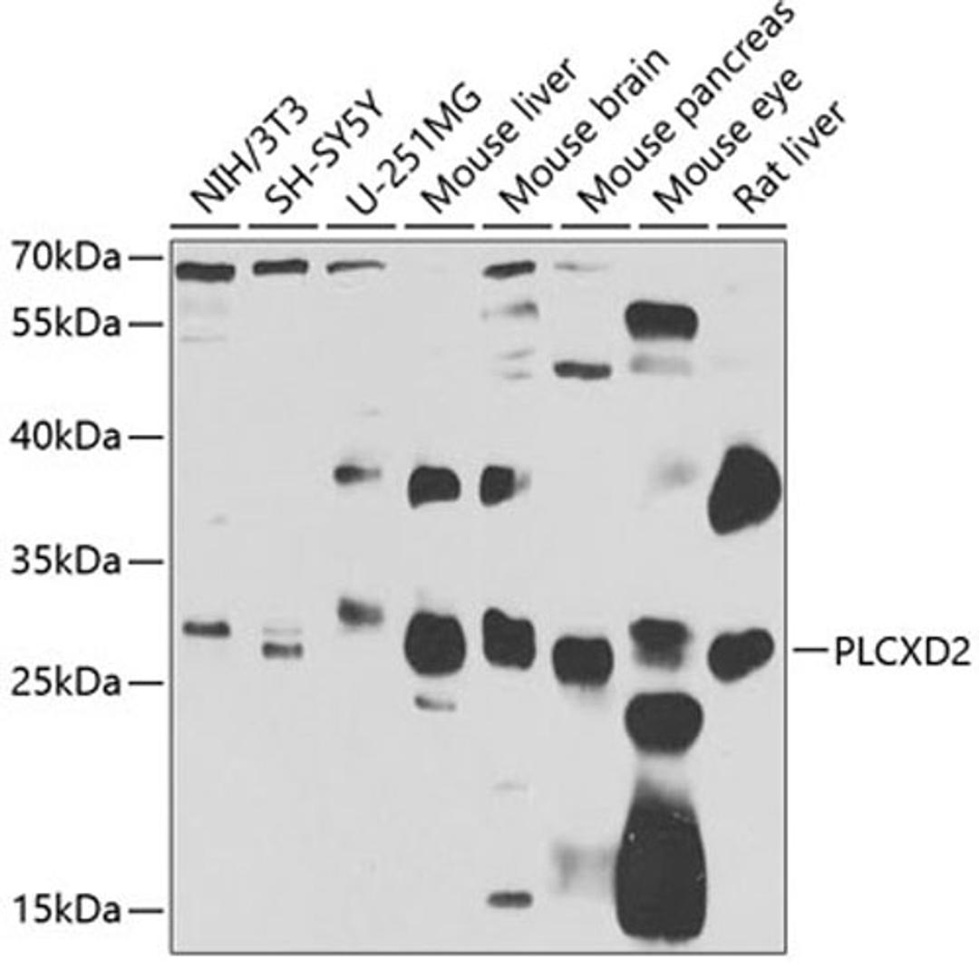 Western blot - PLCXD2 antibody (A7615)