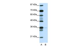 Antibody used in WB on Human Jurkat 1.25 ug/ml.