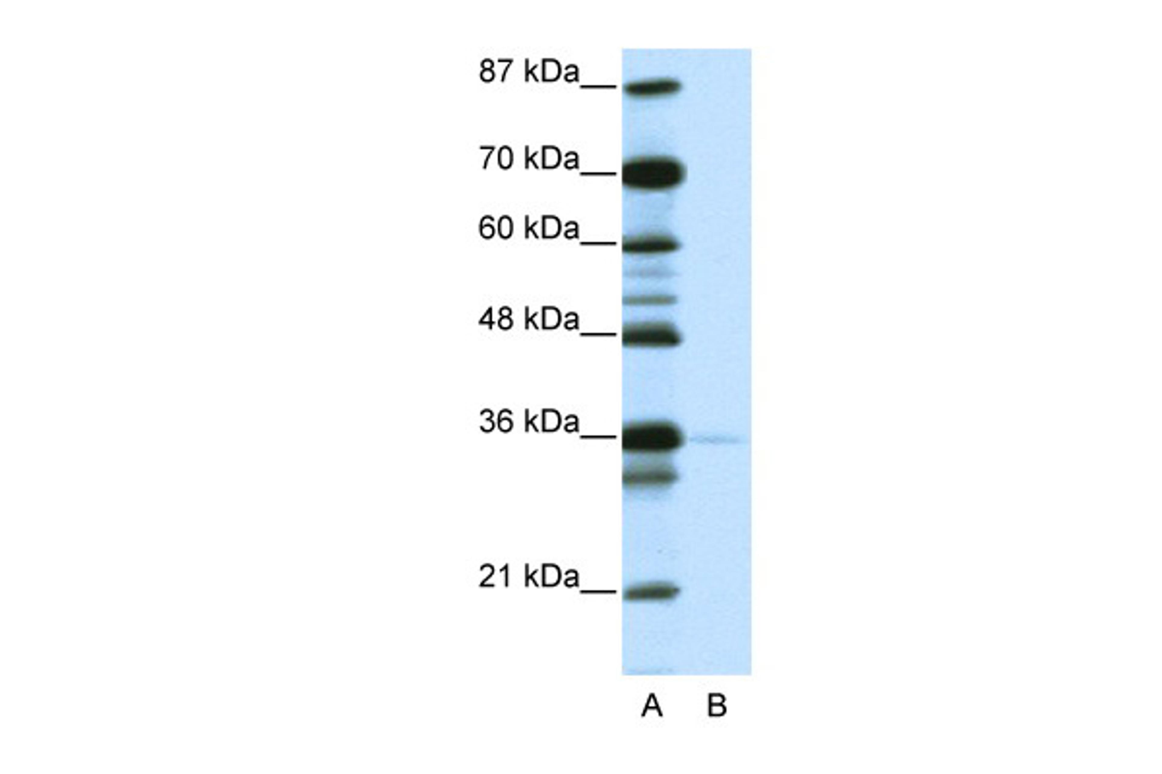 Antibody used in WB on Human Jurkat 1.25 ug/ml.