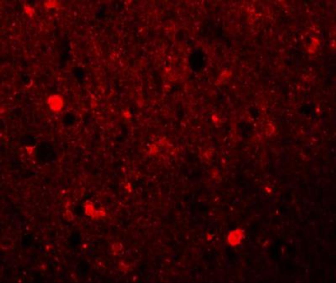 Immunocytochemistry/Immunofluorescence: SRPX Antibody [NBP1-77086] - Immunofluorescence of SRPX1 in human brain tissue with SRPX1 antibody at 20 ug/mL.