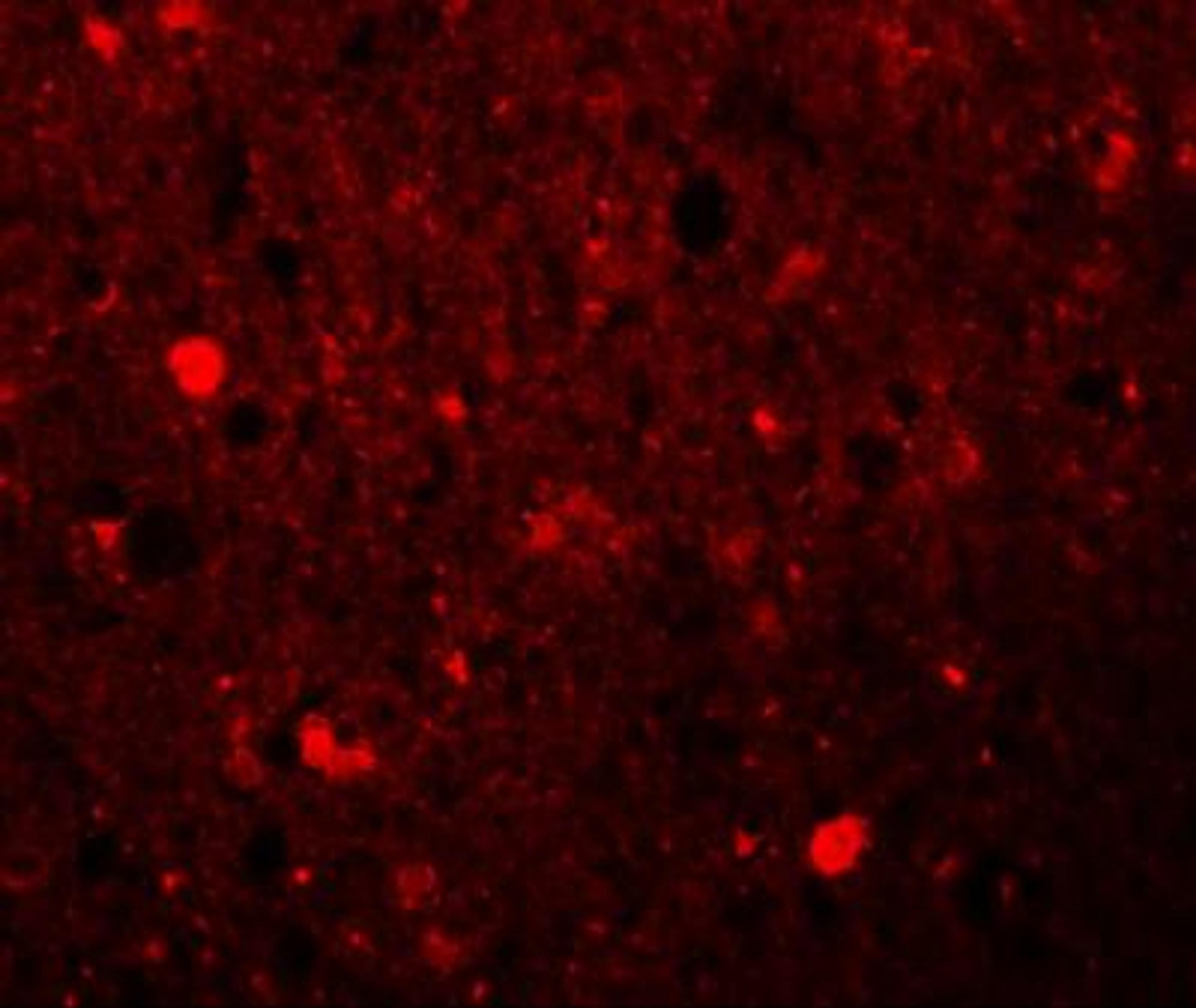 Immunocytochemistry/Immunofluorescence: SRPX Antibody [NBP1-77086] - Immunofluorescence of SRPX1 in human brain tissue with SRPX1 antibody at 20 ug/mL.