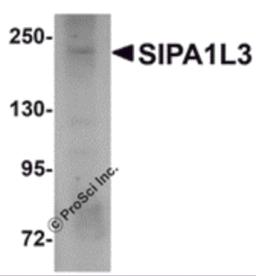 Western blot analysis of SIPA1L3 in SK-N-SH lysate with SIPA1L3 antibody at 1 &#956;g/mL.