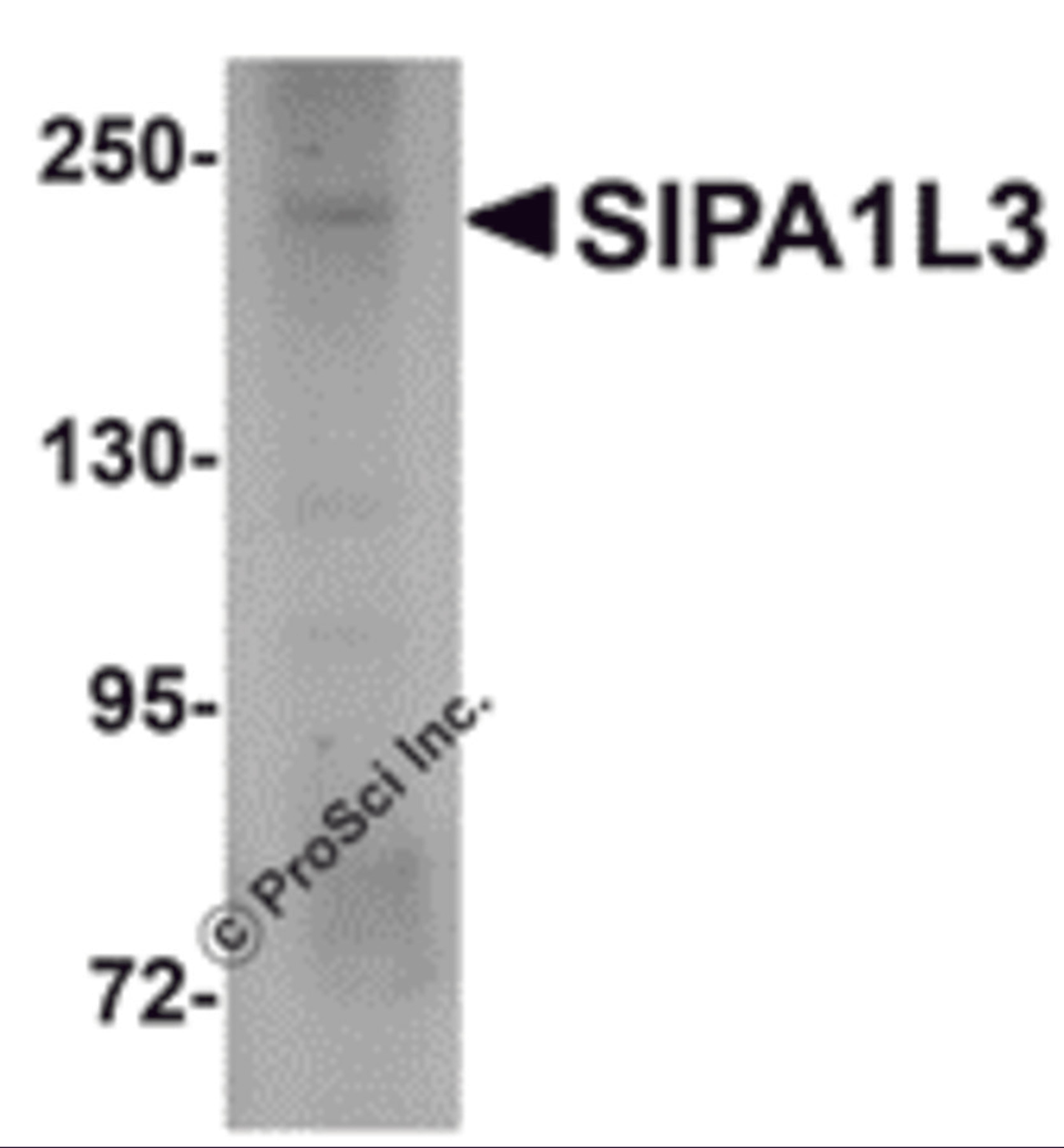 Western blot analysis of SIPA1L3 in SK-N-SH lysate with SIPA1L3 antibody at 1 &#956;g/mL.