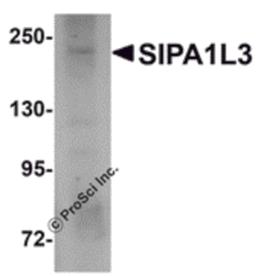 Western blot analysis of SIPA1L3 in SK-N-SH lysate with SIPA1L3 antibody at 1 μg/mL.