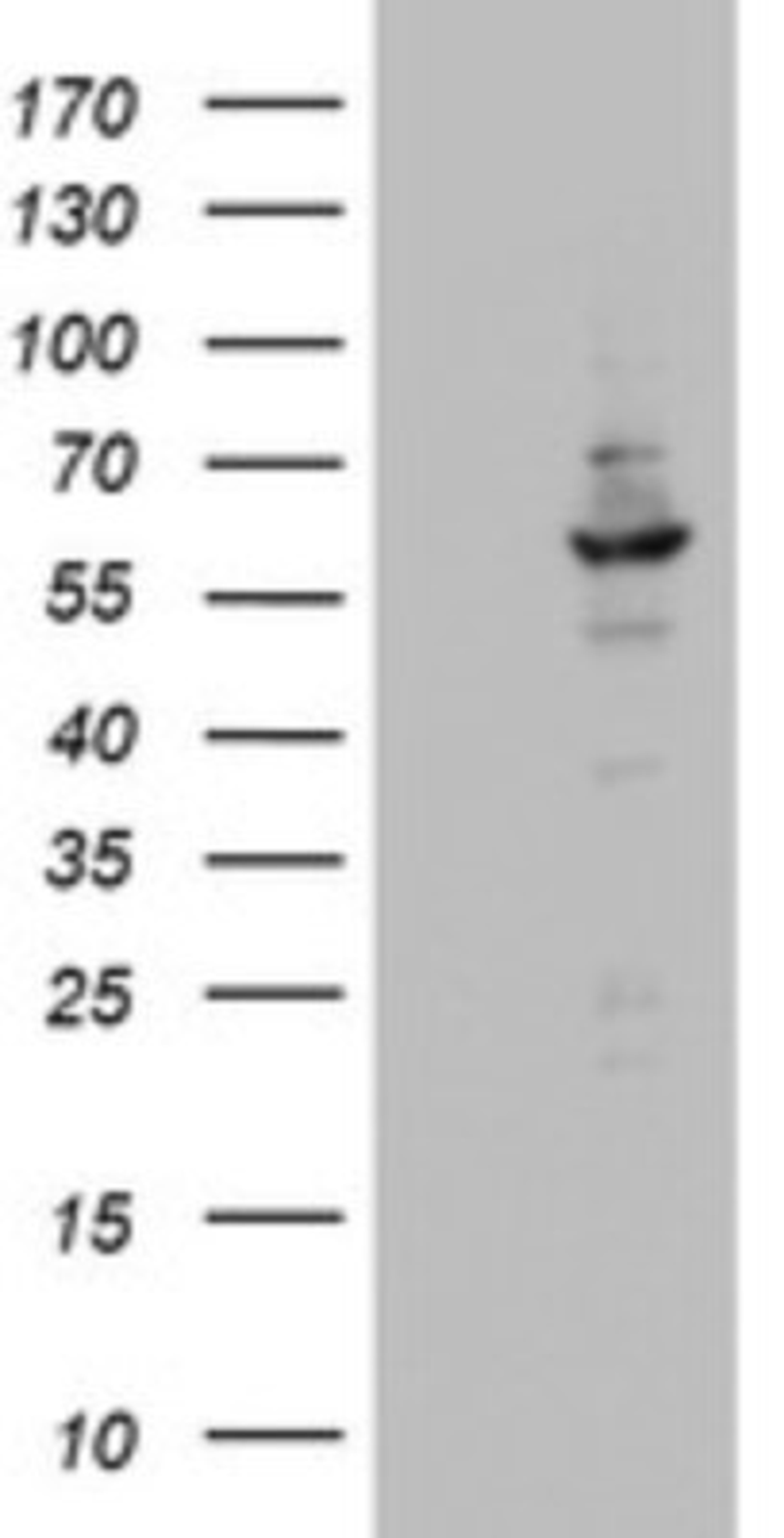 Western Blot: DDX56 Antibody (2E5) [NBP2-46440] - Analysis of HEK293T cells were transfected with the pCMV6-ENTRY control (Left lane) or pCMV6-ENTRY DDX56.