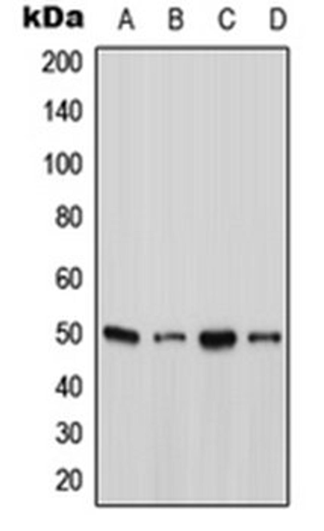 Western blot analysis of A431 (Lane 1), HepG2 (Lane 2), SP2/0 (Lane 3), H9C2 (Lane 4) whole cell lysates using ATXN10 antibody