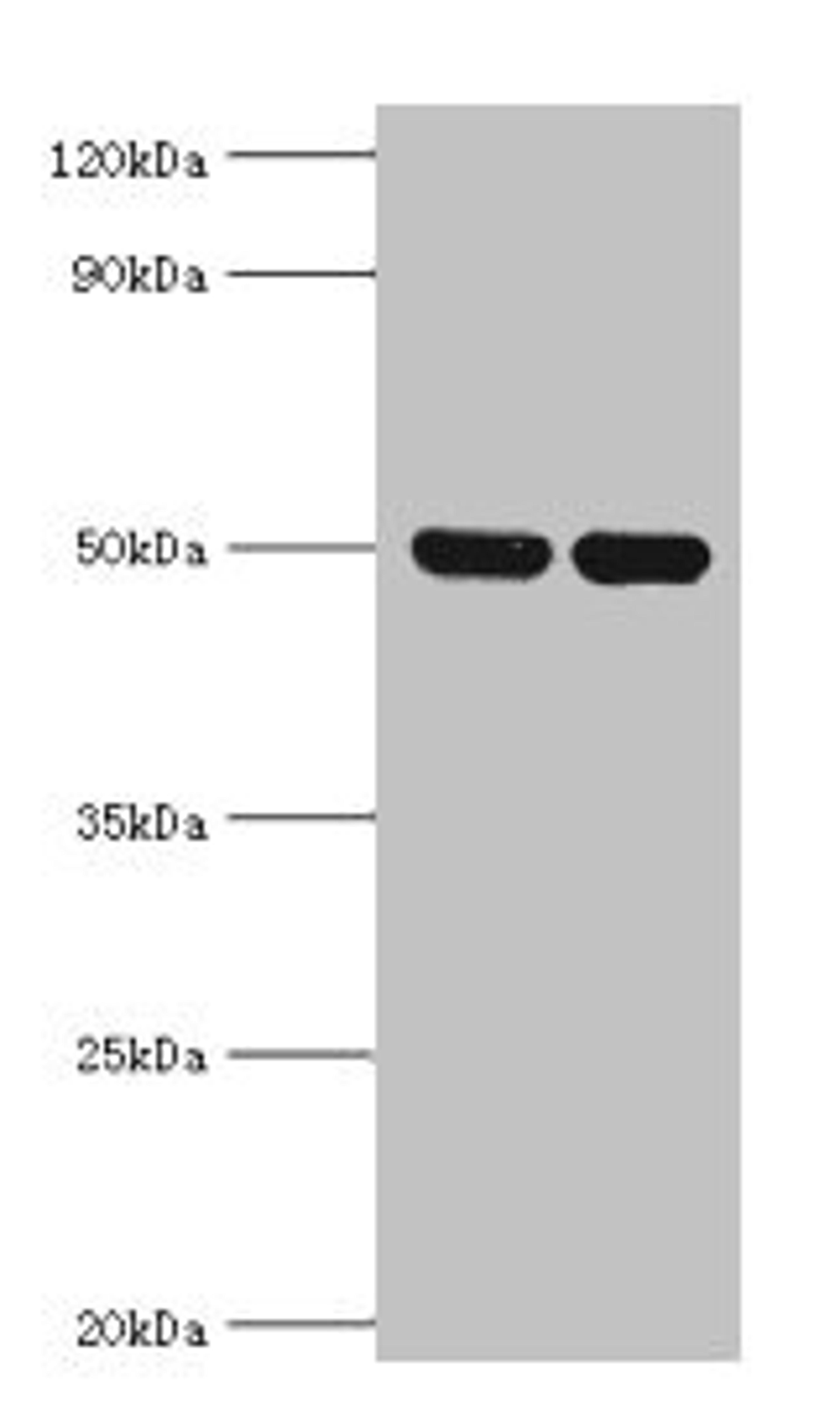 Western blot. All lanes: IDH2 antibody at 5ug/ml. Lane 1: Hela whole cell lysate. Lane 2: Mouse heart tissue. Secondary. Goat polyclonal to rabbit IgG at 1/10000 dilution. Predicted band size: 51, 46 kDa. Observed band size: 51 kDa.