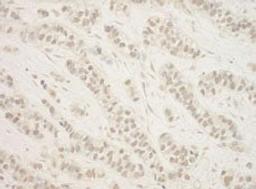 Detection of human BHD by immunohistochemistry.