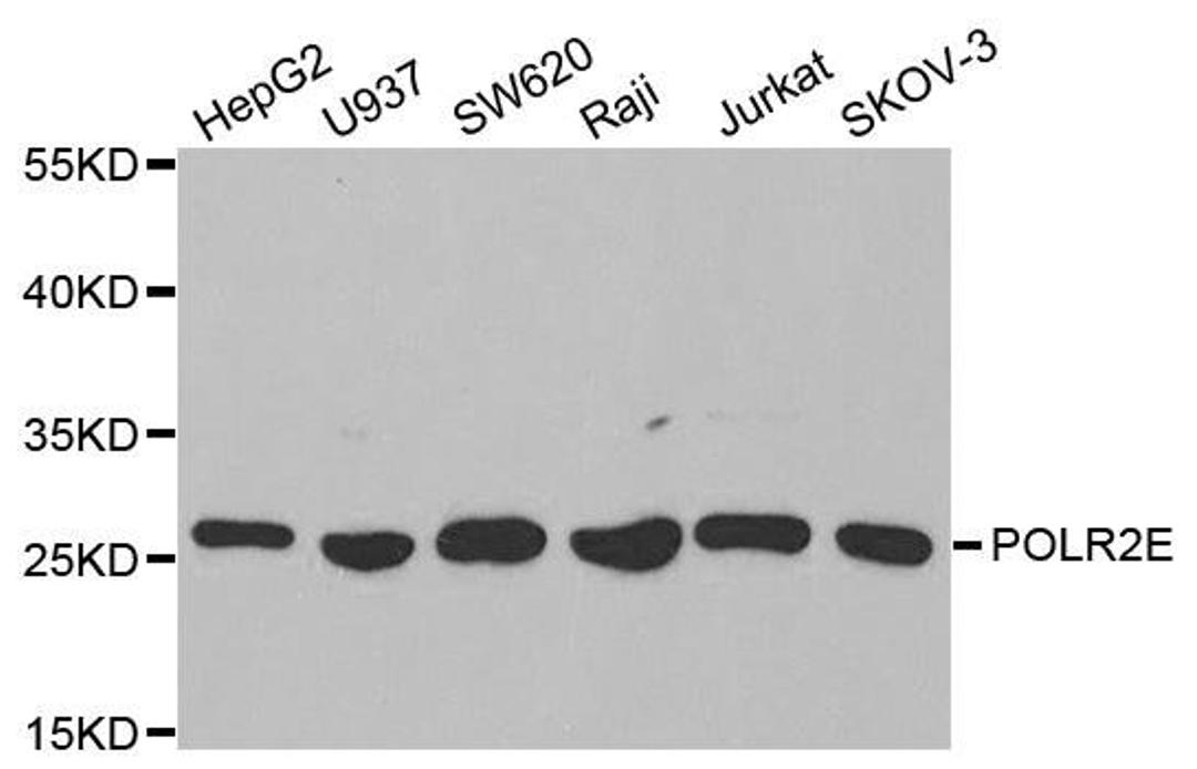 Western blot analysis of extracts of various cell lines using POLR2E antibody