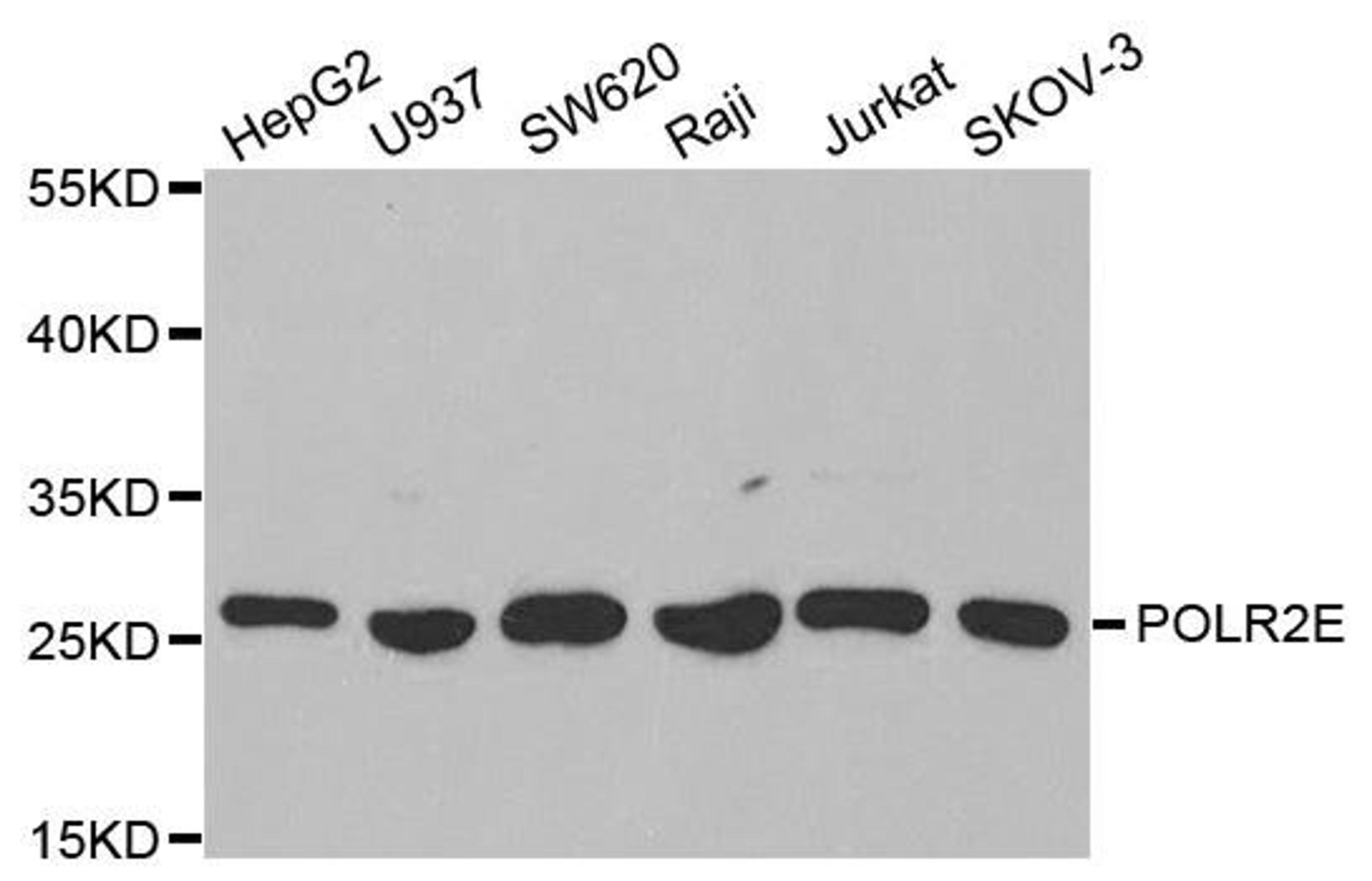 Western blot analysis of extracts of various cell lines using POLR2E antibody