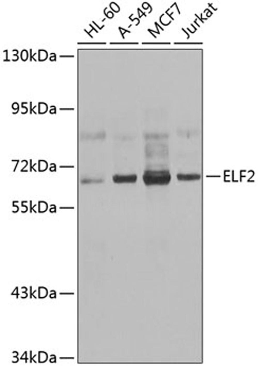 Western blot - ELF2 antibody (A7487)