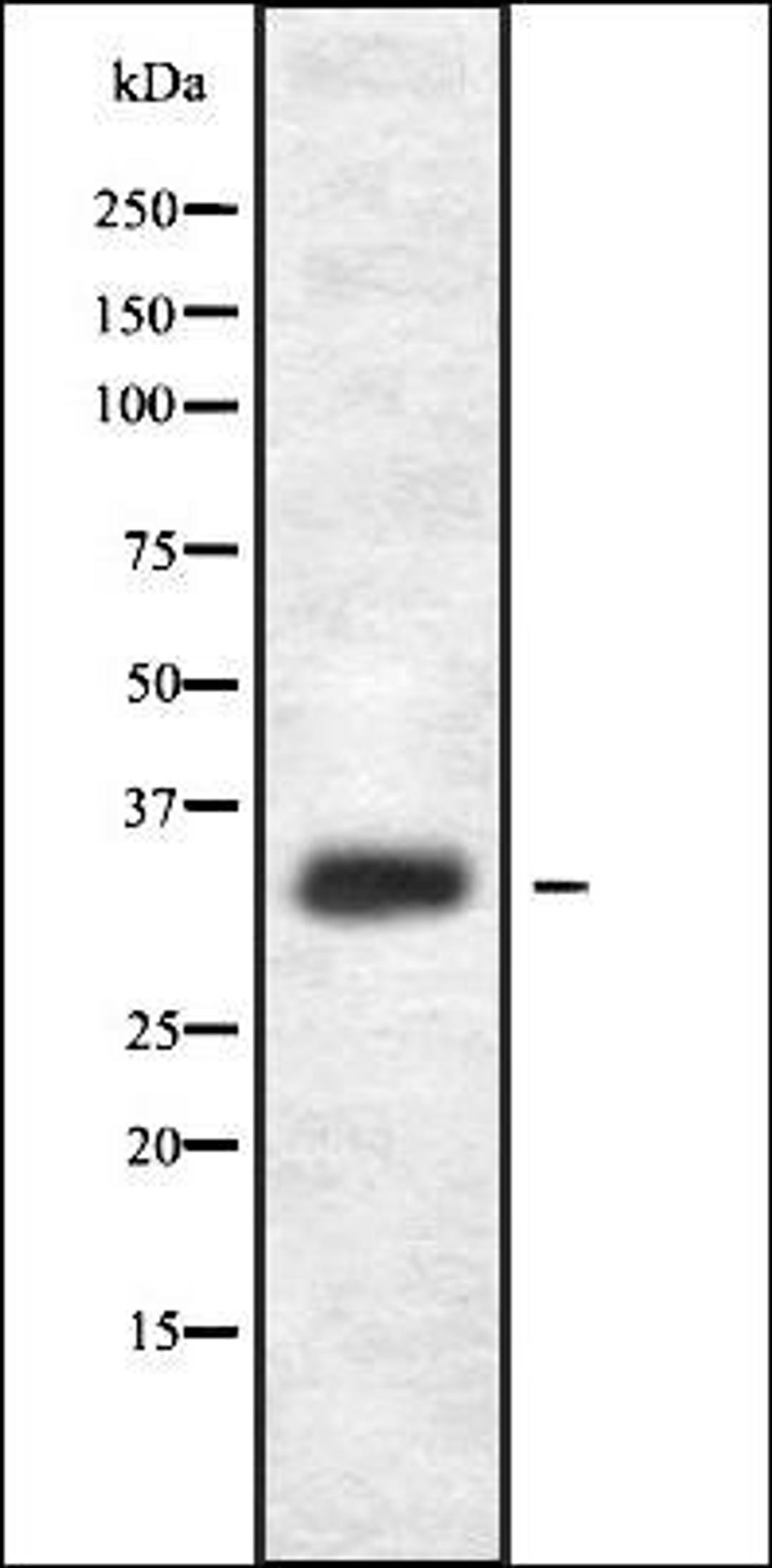 Western blot analysis of HEK293 cells using HOR5'Beta13 antibody