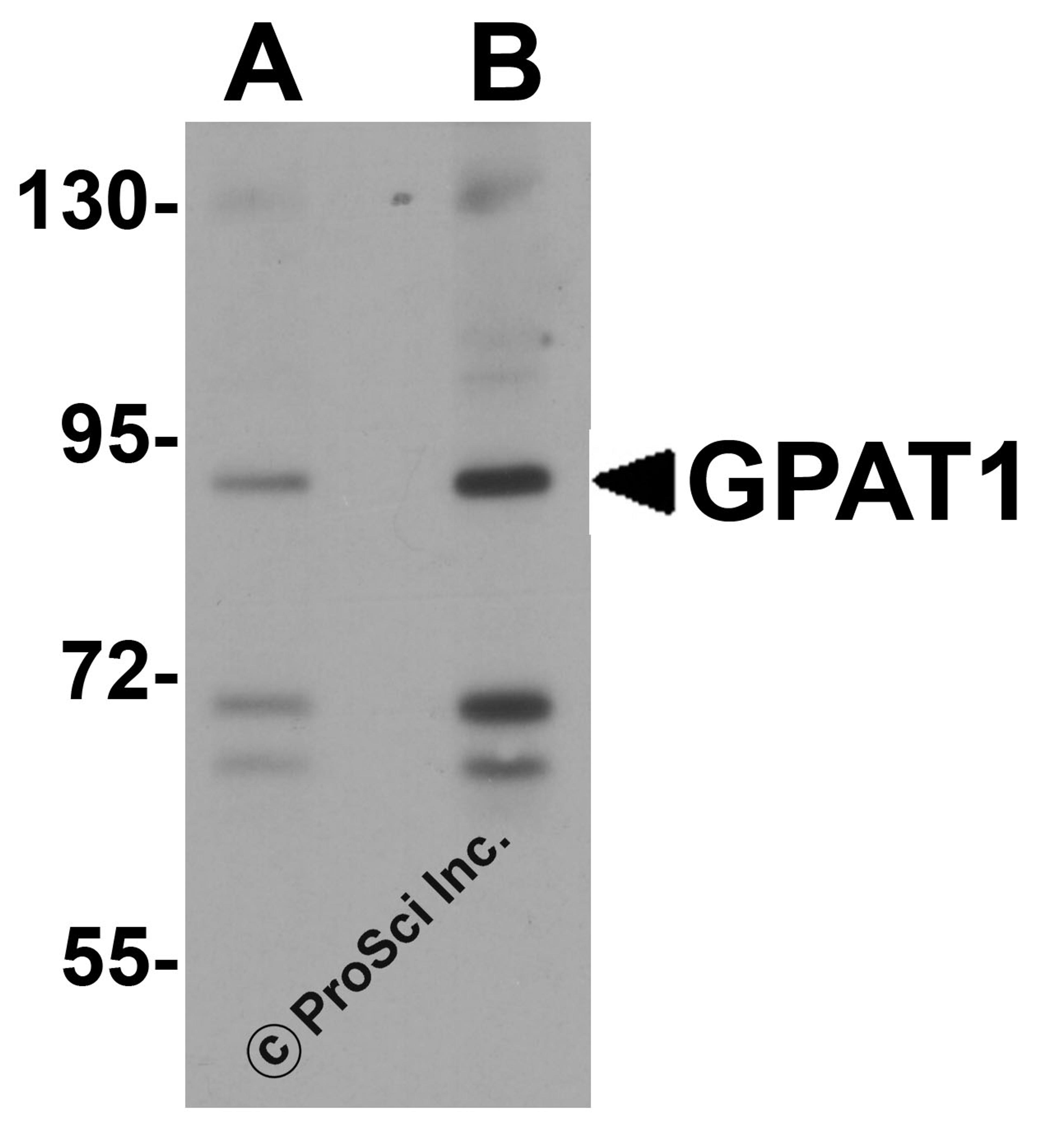 Western blot analysis of GPAT1 in rat brain tissue lysate with GPAT1 antibody at (A) 1 and (B) 2 &#956;g/mL.