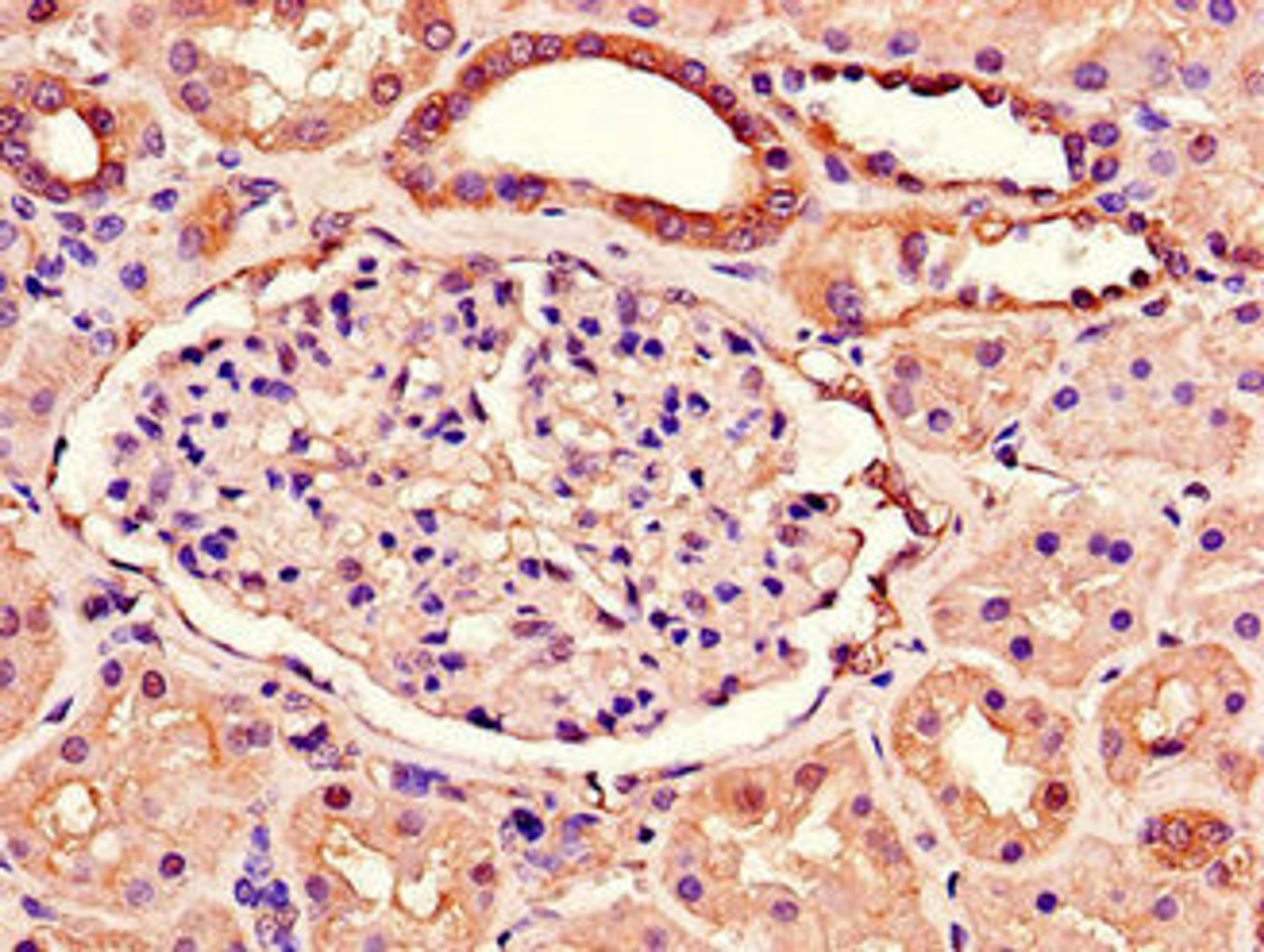 Immunohistochemistry of paraffin-embedded human kidney tissue using CSB-PA853488LA01HU at dilution of 1:100