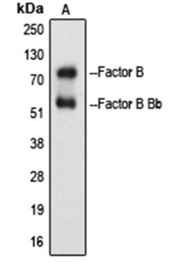 Western blot analysis of Raji Etoposide-treated (Lane 1) whole cell lysates using Factor B Bb antibody