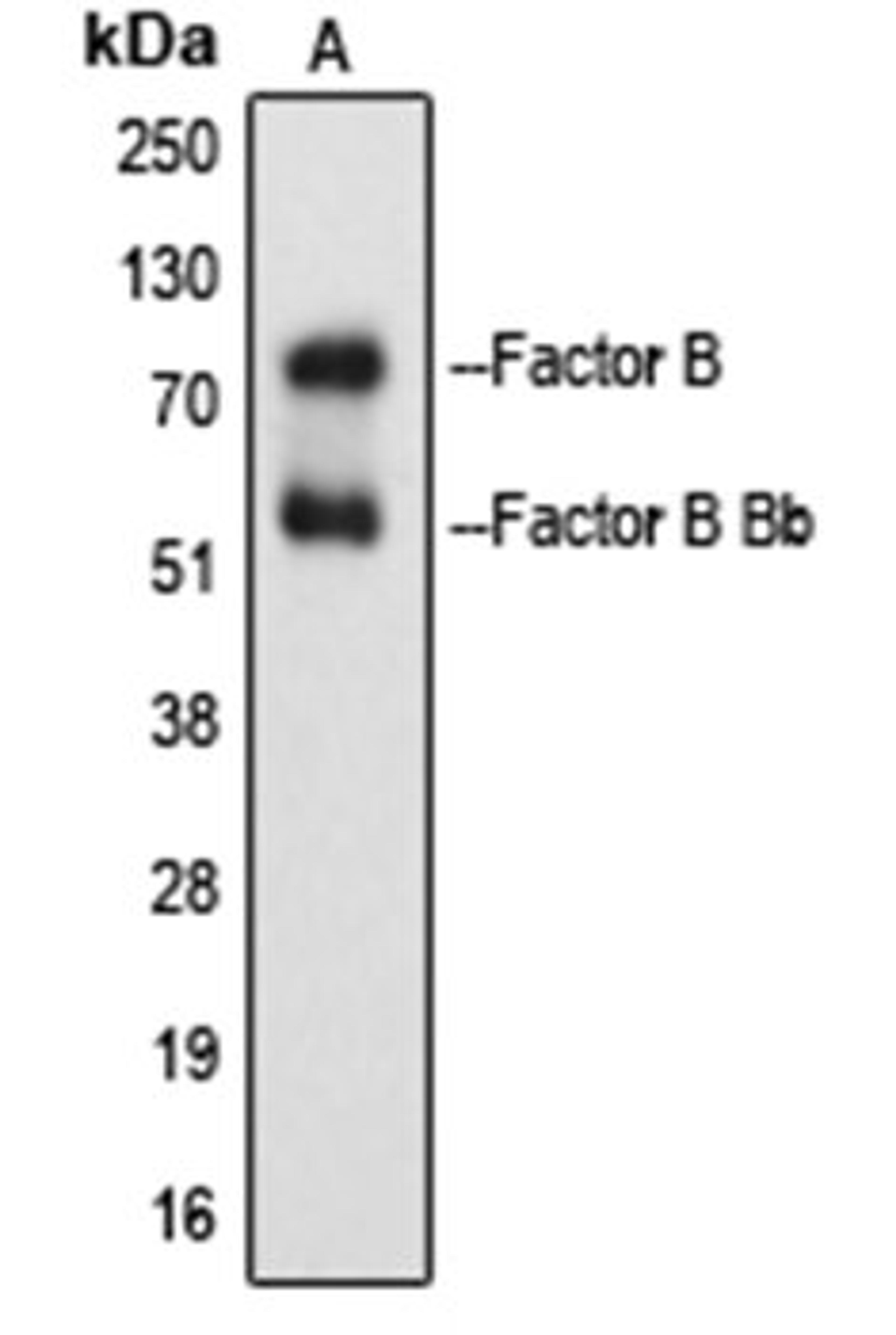 Western blot analysis of Raji Etoposide-treated (Lane 1) whole cell lysates using Factor B Bb antibody