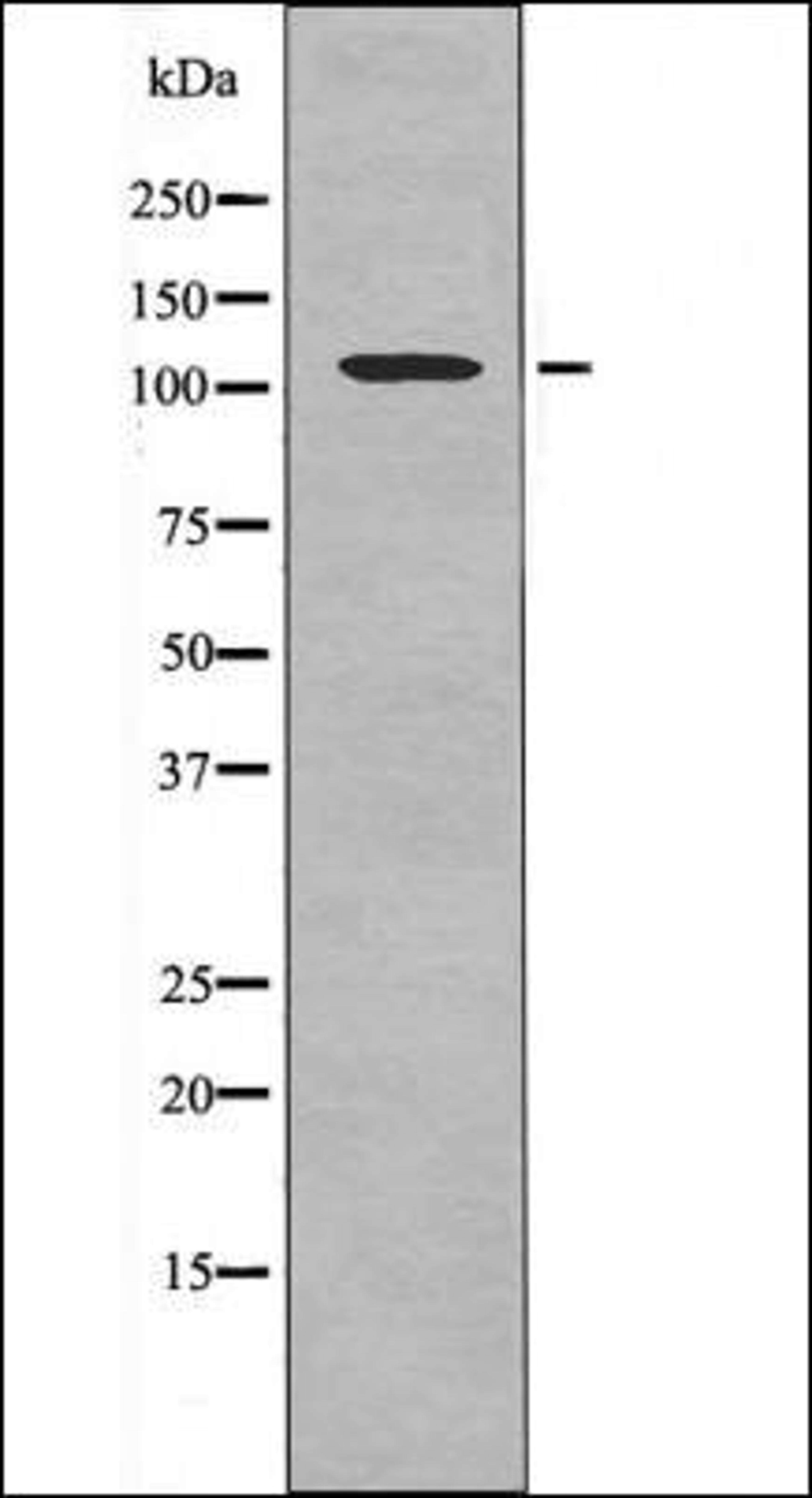 Western blot analysis of K562 whole cell lysates using Retinoblastoma -Phospho-Ser788- antibody