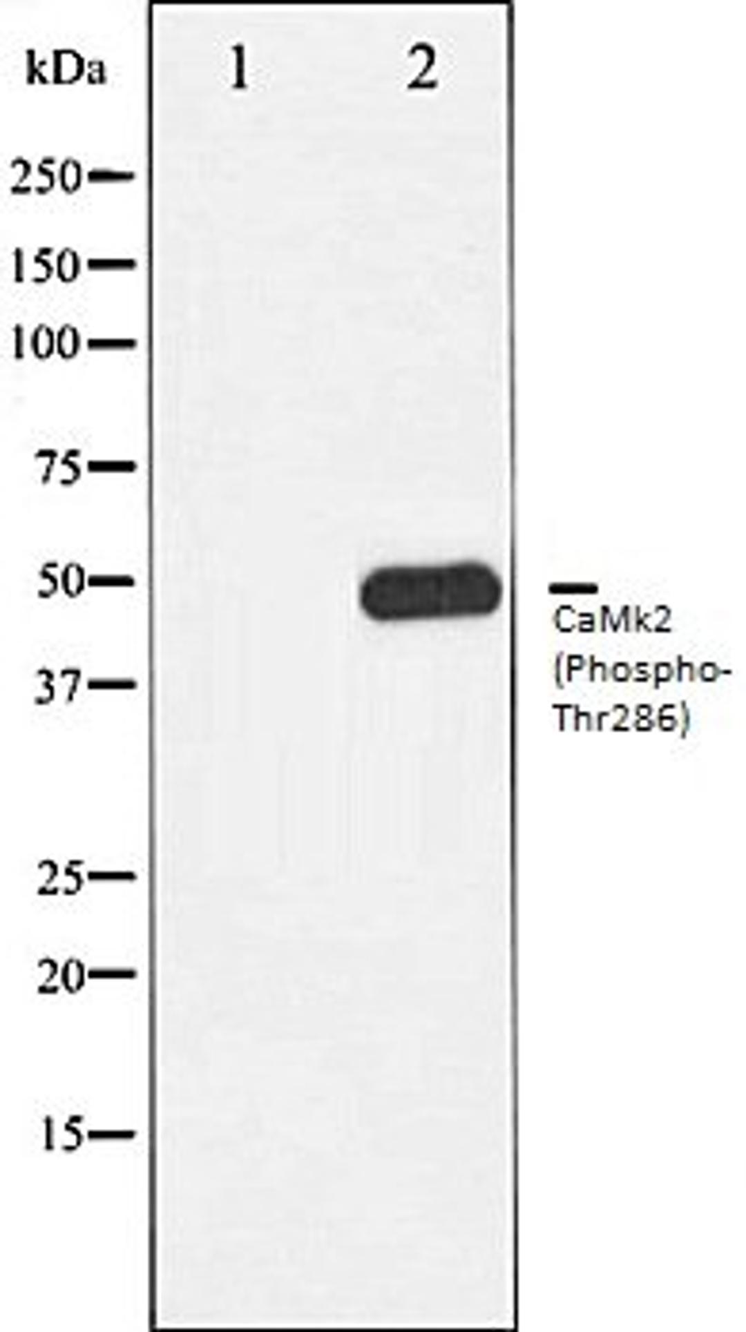 Western blot analysis of K562 whole cell lysates using CaMK2 (Phospho-Thr286) antibody, The lane on the left is treated with the antigen-specific peptide.