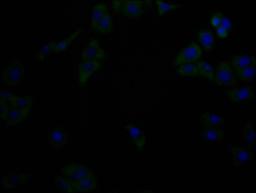 Immunofluorescence staining of Hela cells with(CSB-MA816871A0m)at 1:90, counter-stained with DAPI. The cells were fixed in 4% formaldehyde, permeabilized using 0.2% Triton X-100 and blocked in 10% normal Goat Serum. The cells were then incubated with the antibody overnight at 4°C. Nuclear DNA was labeled in blue with DAPI. The secondary antibody was FITC-conjugated AffiniPure Goat Anti-Mouse IgG (H+L).