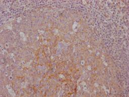 IHC image of CSB-MA792948 diluted at 1:100 and staining in paraffin-embedded human tonsil tissue performed on a Leica BondTM system. After dewaxing and hydration, antigen retrieval was mediated by high pressure in a citrate buffer (pH 6.0). Section was blocked with 10% normal goat serum 30min at RT. Then primary antibody (1% BSA) was incubated at 4°C overnight. The primary is detected by a Goat anti-mouse IgG polymer labeled by HRP and visualized using 0.05% DAB.