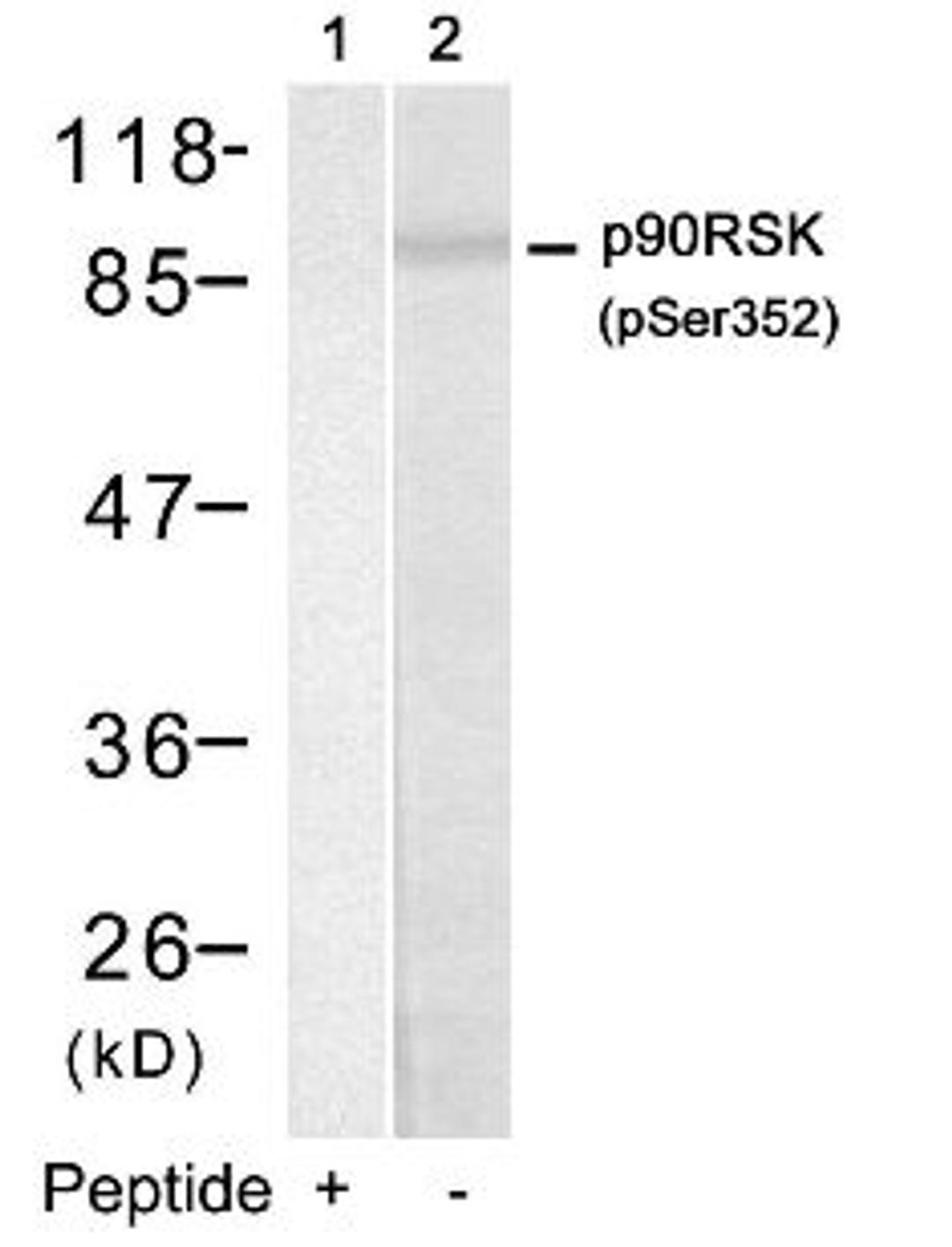 Western blot analysis of lysed extracts from HUVEC cells using p90RSK (Phospho-Ser352).