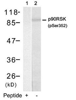 Western blot analysis of lysed extracts from HUVEC cells using p90RSK (Phospho-Ser352).