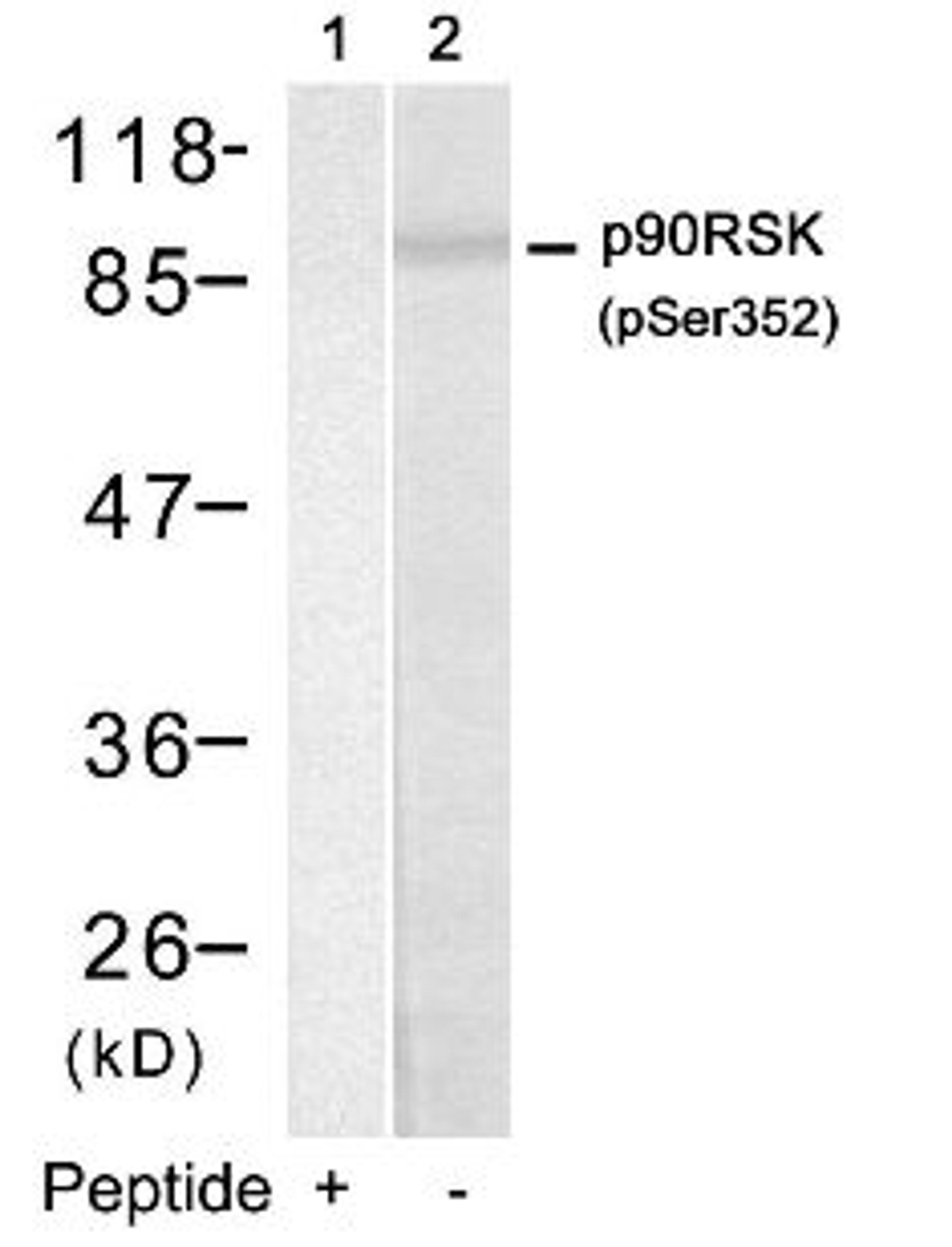 Western blot analysis of lysed extracts from HUVEC cells using p90RSK (Phospho-Ser352).