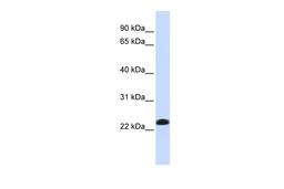 Antibody used in WB on Human Lung at 0.2-1 ug/ml.