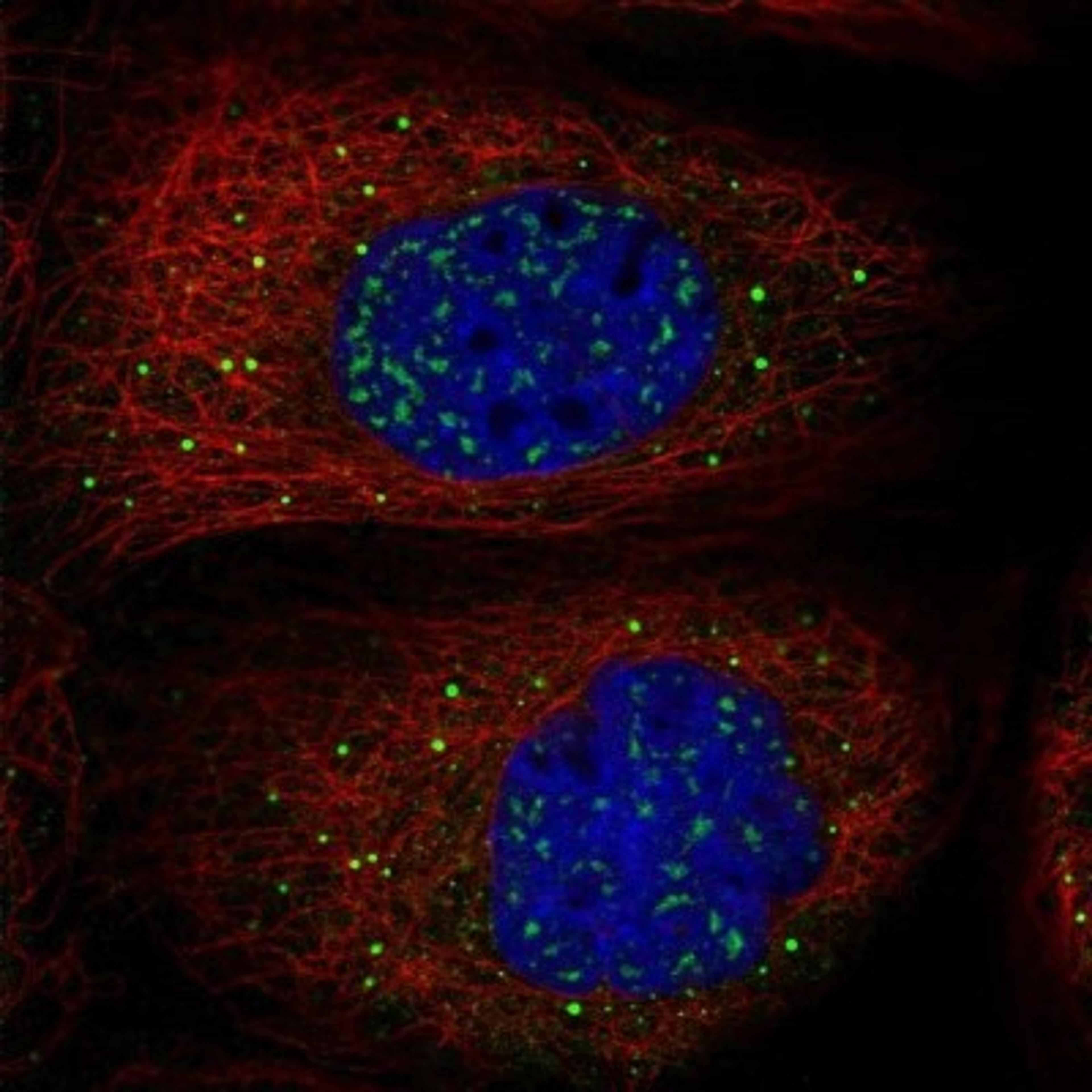 Immunocytochemistry/Immunofluorescence: Myosin VB Antibody [NBP1-87746] - Staining of human cell line A-431 shows positivity in nucleus but not nucleoli & vesicles.