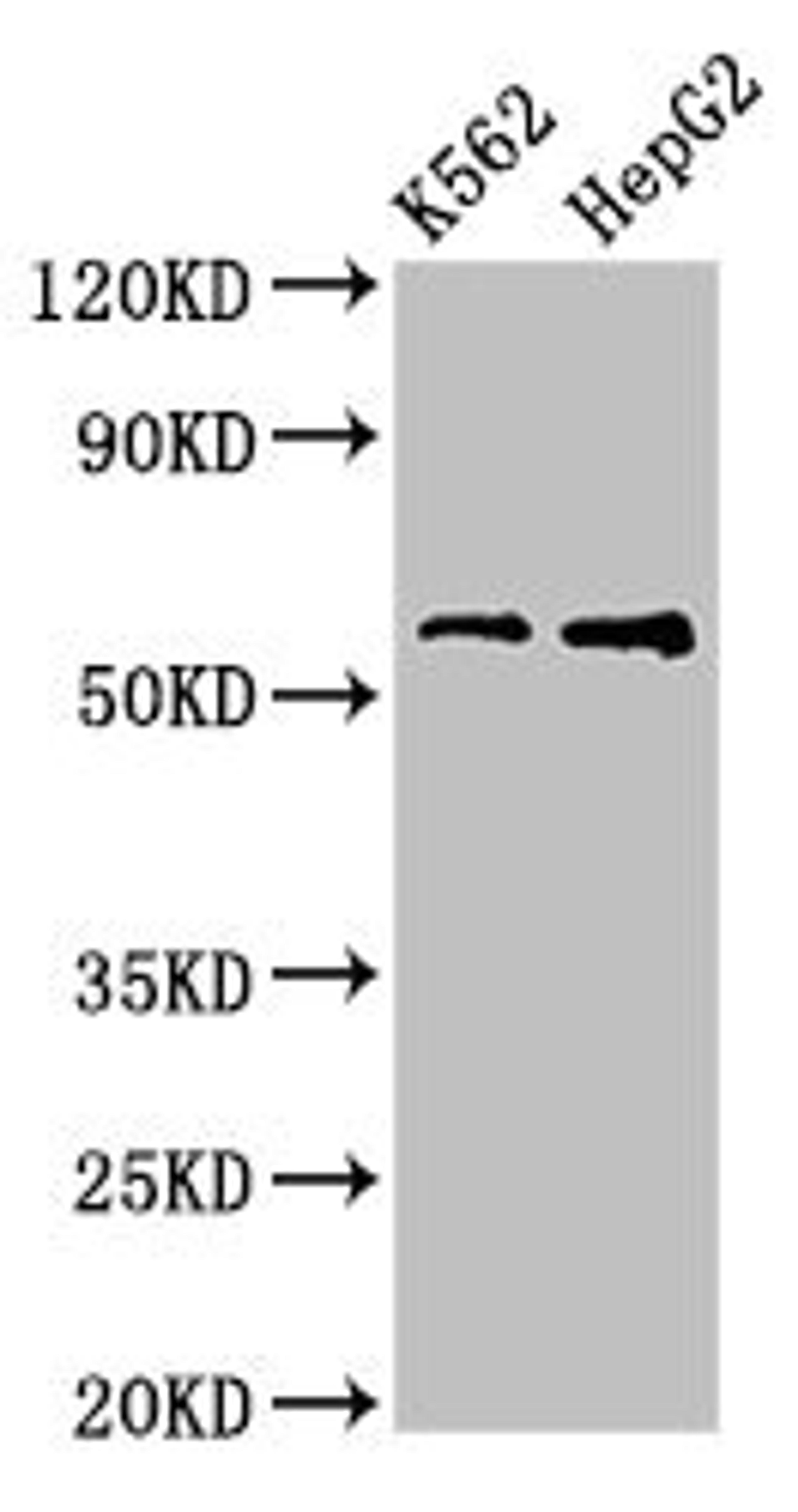 Western Blot. Positive WB detected in: K562 whole cell lysate, HepG2 whole cell lysate. All lanes: FSCN1 antibody at 3.2ug/ml. Secondary. Goat polyclonal to rabbit IgG at 1/50000 dilution. Predicted band size: 55 kDa. Observed band size: 55 kDa. 