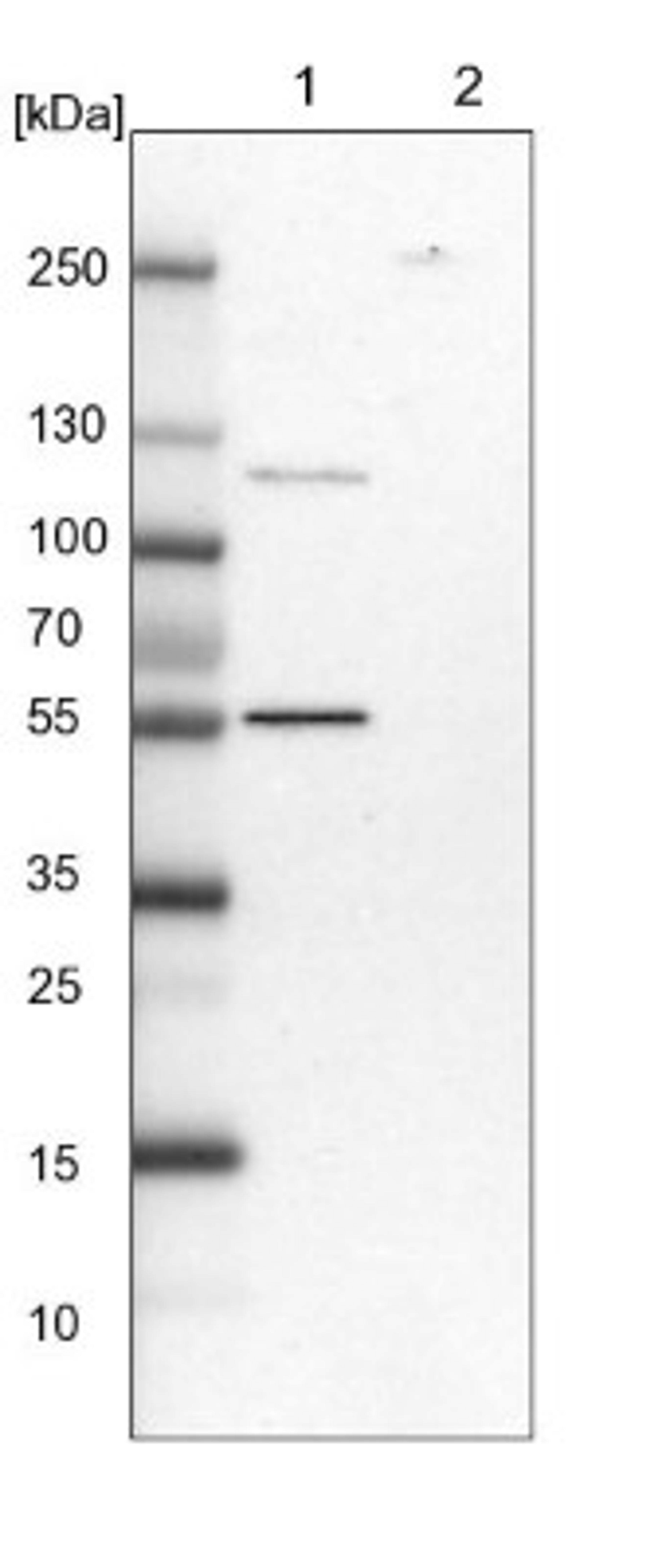 Western Blot: DARS Antibody [NBP1-85937] - Lane 1: NIH-3T3 cell lysate (Mouse embryonic fibroblast cells)<br/>Lane 2: NBT-II cell lysate (Rat Wistar bladder tumour cells)