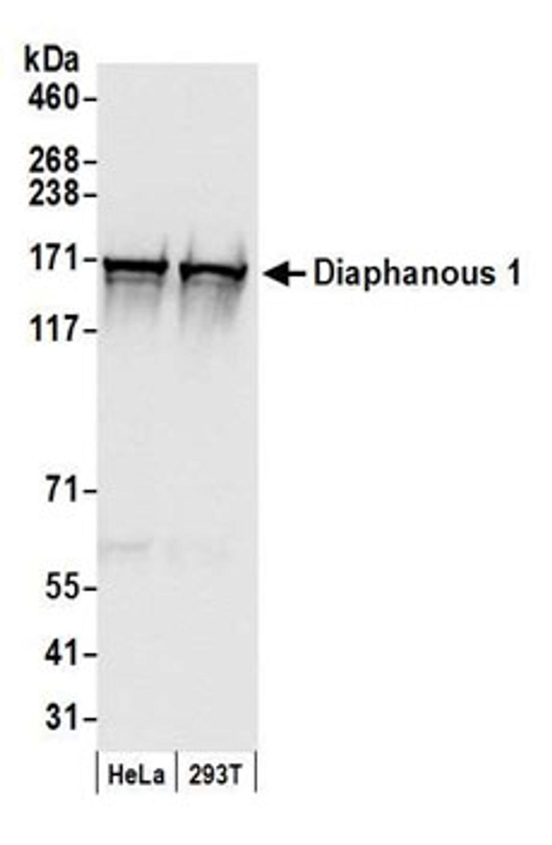 Detection of human Diaphanous 1 by western blot.