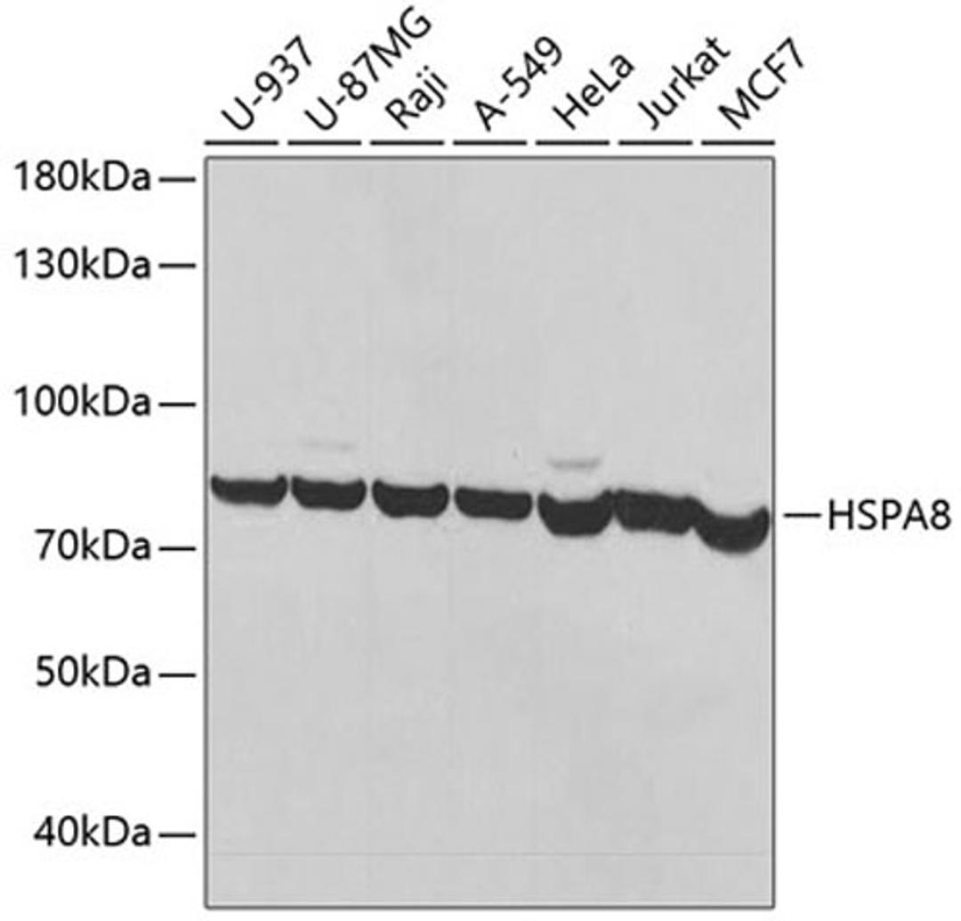 Western blot - HSPA8 antibody (A14001)