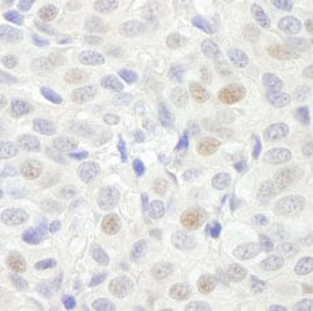 Detection of human GTF3C3/TFIIIC102 by immunohistochemistry.