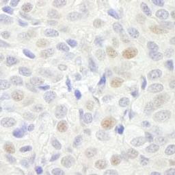 Detection of human GTF3C3/TFIIIC102 by immunohistochemistry.