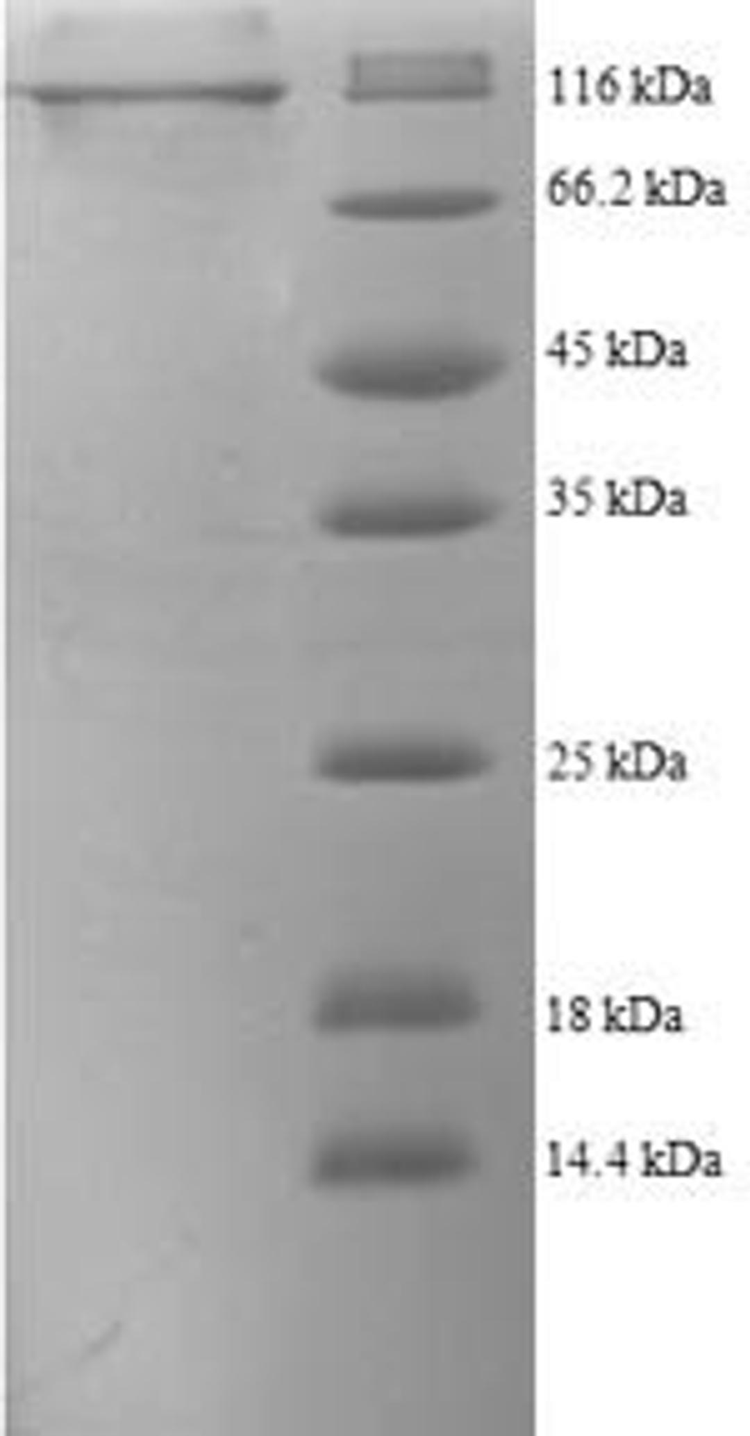 (Tris-Glycine gel) Discontinuous SDS-PAGE (reduced) with 5% enrichment gel and 15% separation gel.
