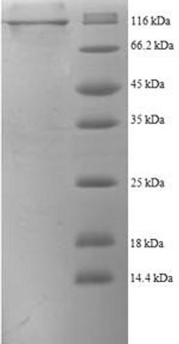 (Tris-Glycine gel) Discontinuous SDS-PAGE (reduced) with 5% enrichment gel and 15% separation gel.