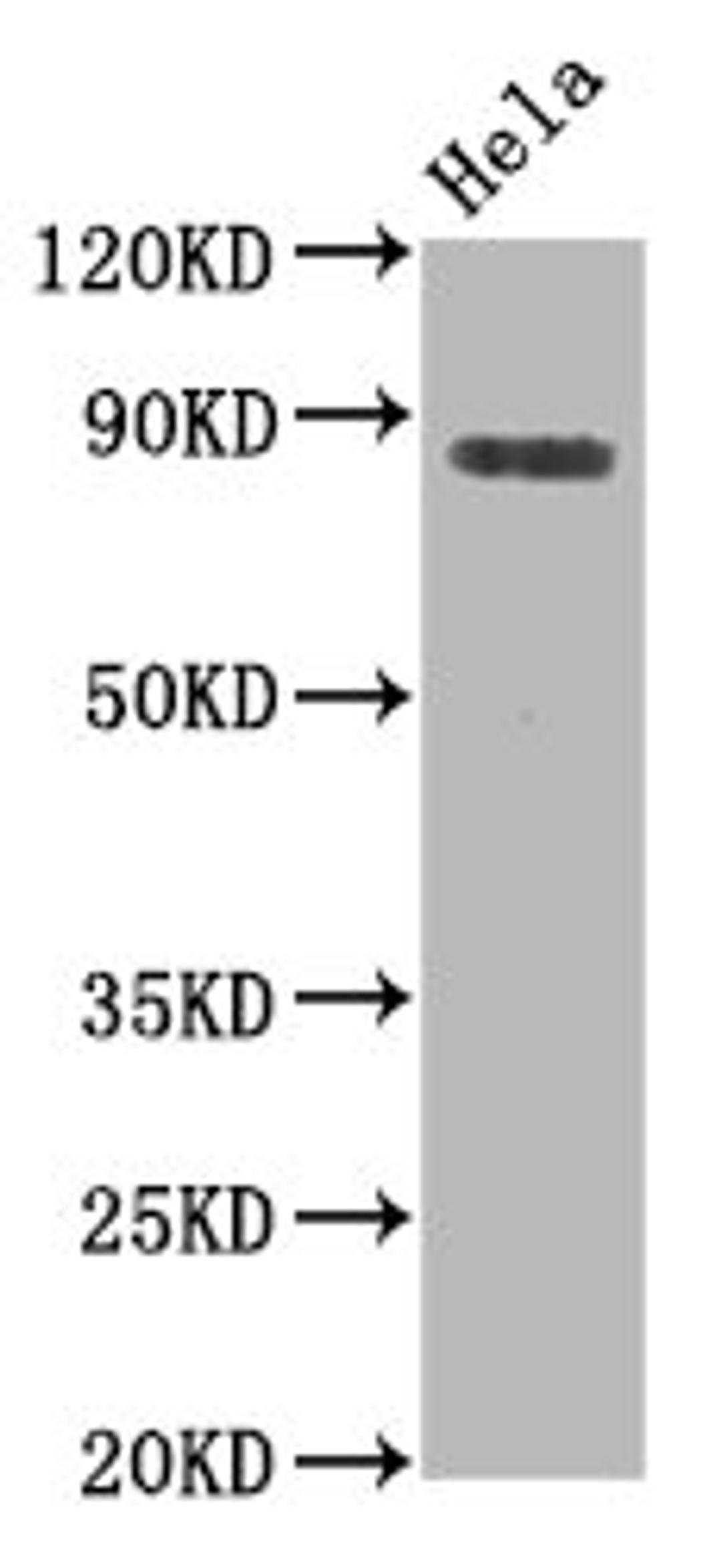 Western Blot. Positive WB detected in Hela whole cell lysate. All lanes Phospho-HSF1 antibody at 0.8μg/ml. Secondary. Goat polyclonal to rabbit IgG at 1/50000 dilution. Predicted band size: 82 KDa. Observed band size: 82 KDa. 