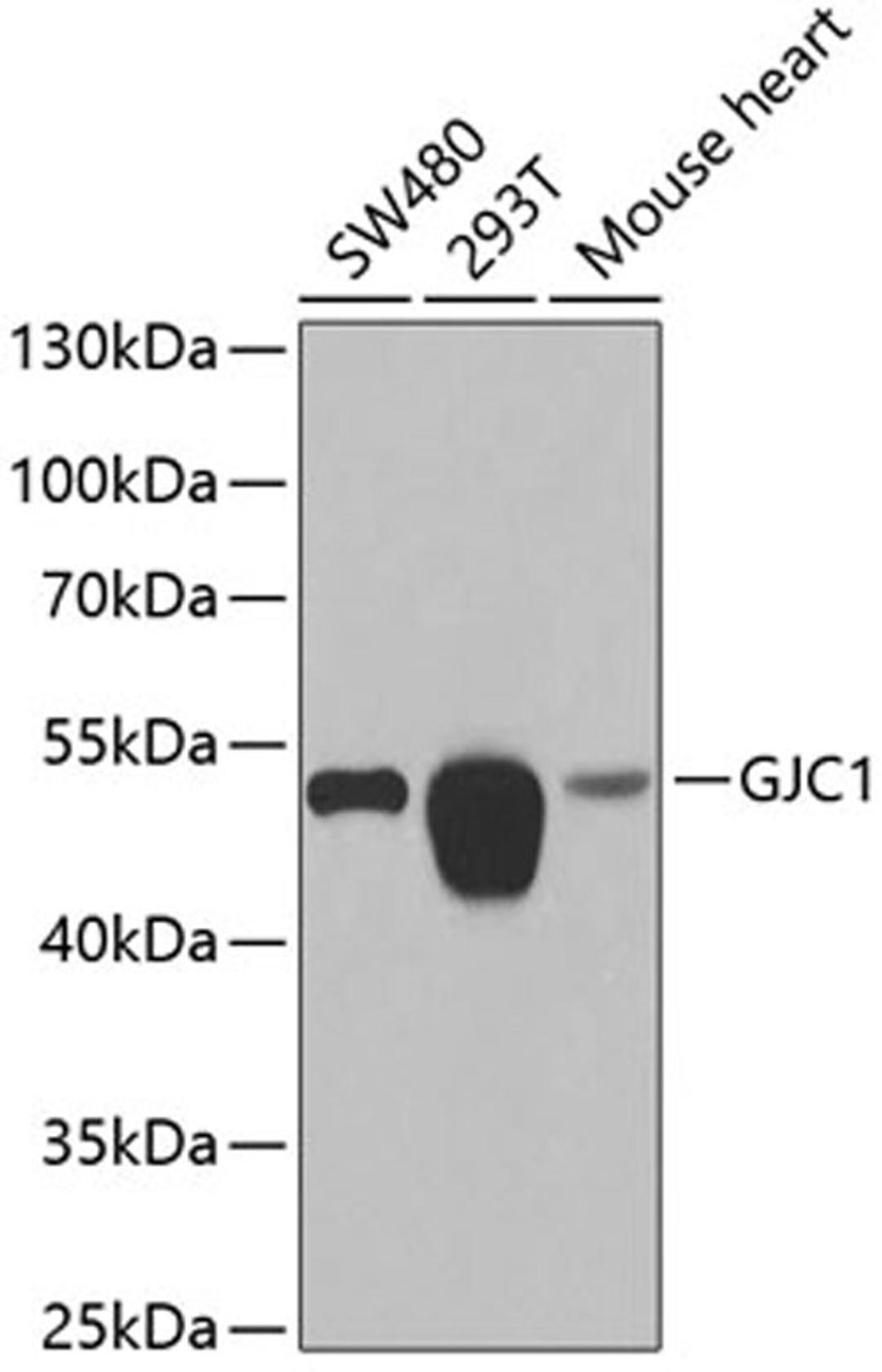 Western blot - GJC1 antibody (A7053)