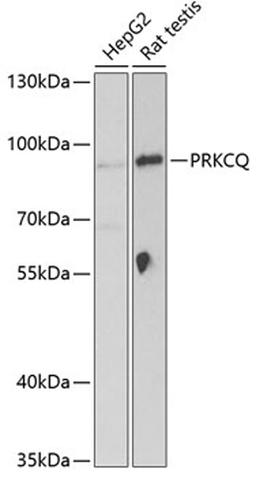 Western blot - PRKCQ Antibody (A5834)