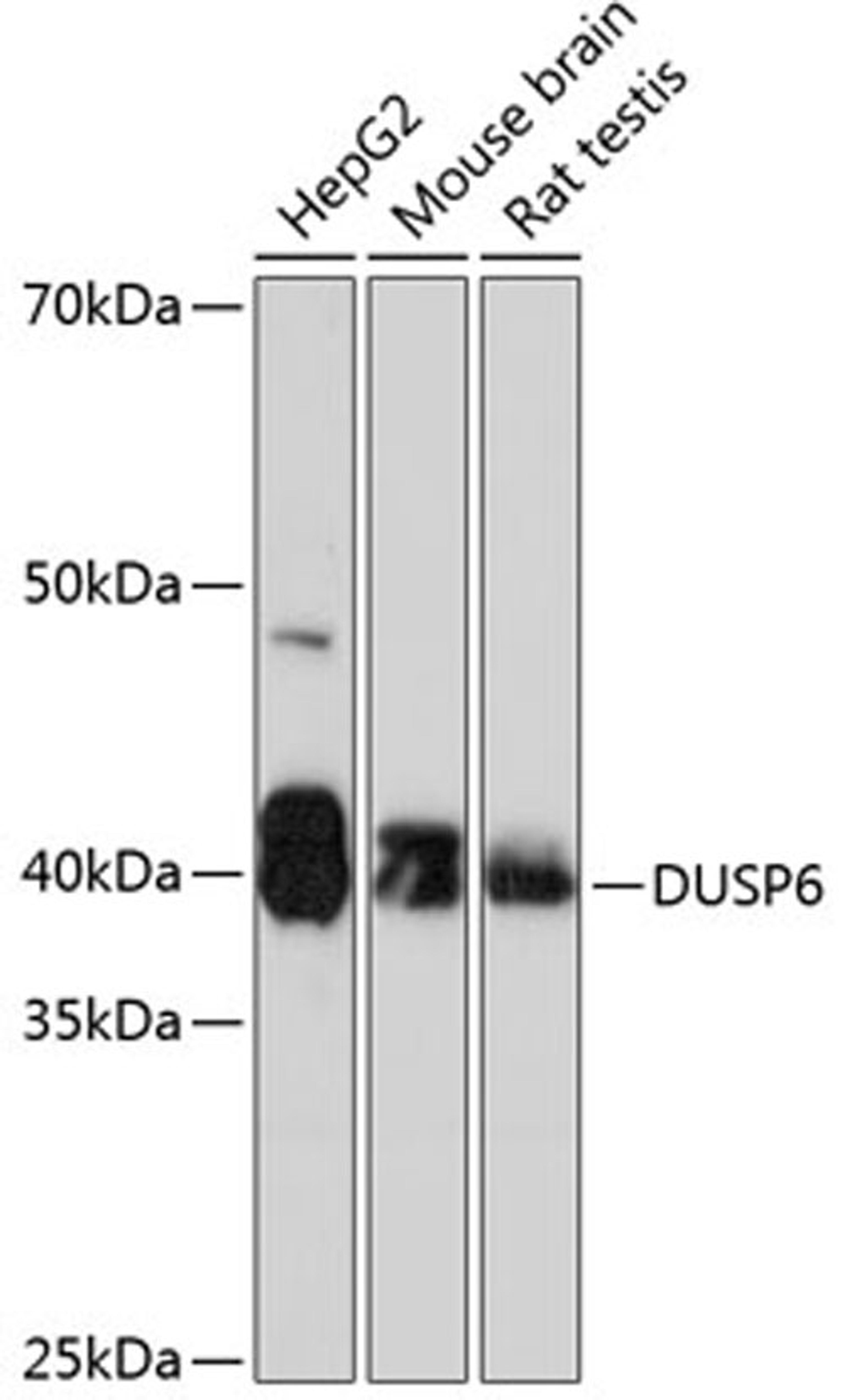 Western blot - DUSP6 Rabbit mAb (A0133)