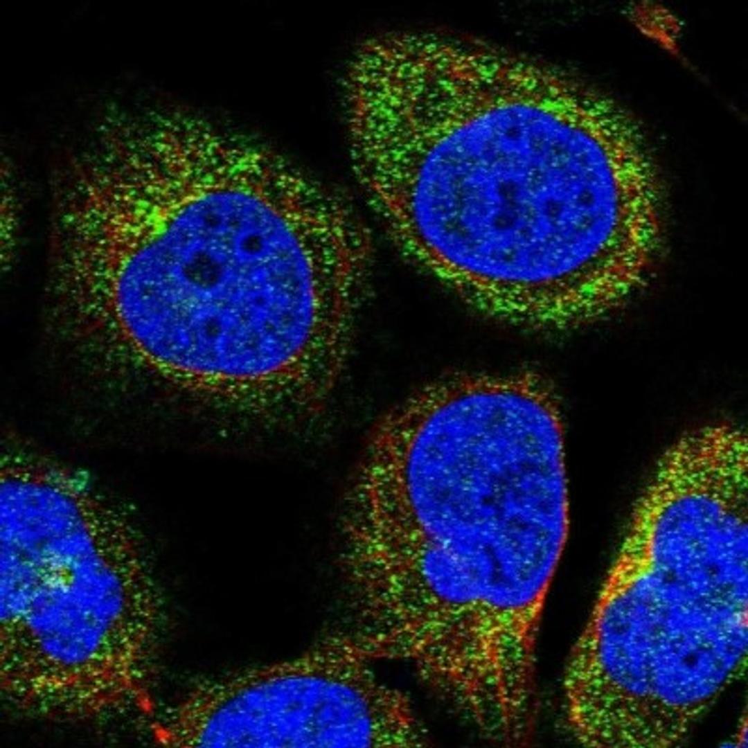 Immunocytochemistry/Immunofluorescence: OSBPL2 Antibody [NBP1-92236] - Staining of human cell line U-2 OS shows positivity in cytoplasm.