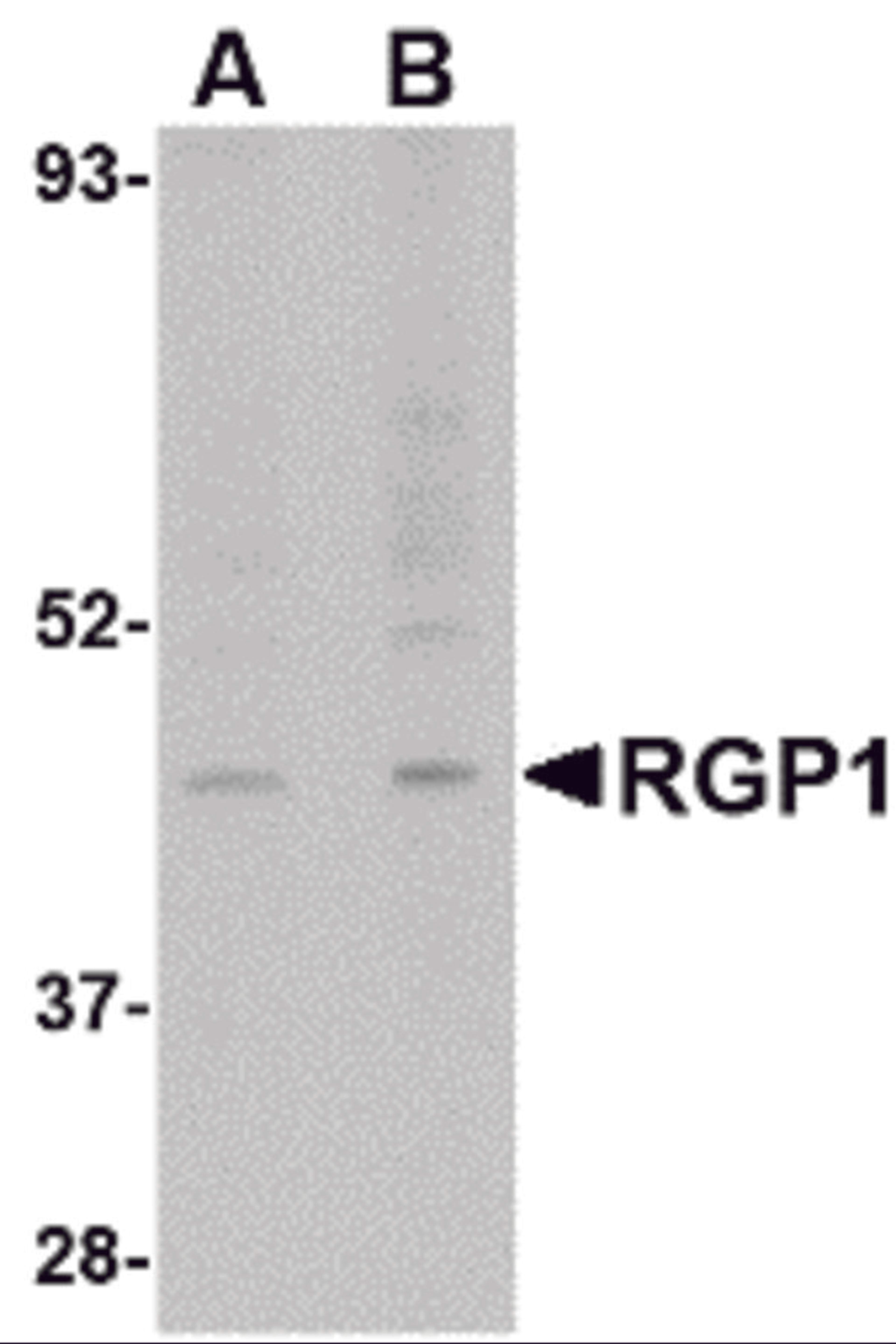 Western blot analysis of RGP1 in human heart tissue lysate with RGP1 antibody at (A) 1 and (B) 2 &#956;g/mL.