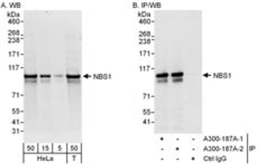 Detection of human NBS1 by western blot and immunoprecipitation.