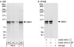 Detection of human NBS1 by western blot and immunoprecipitation.