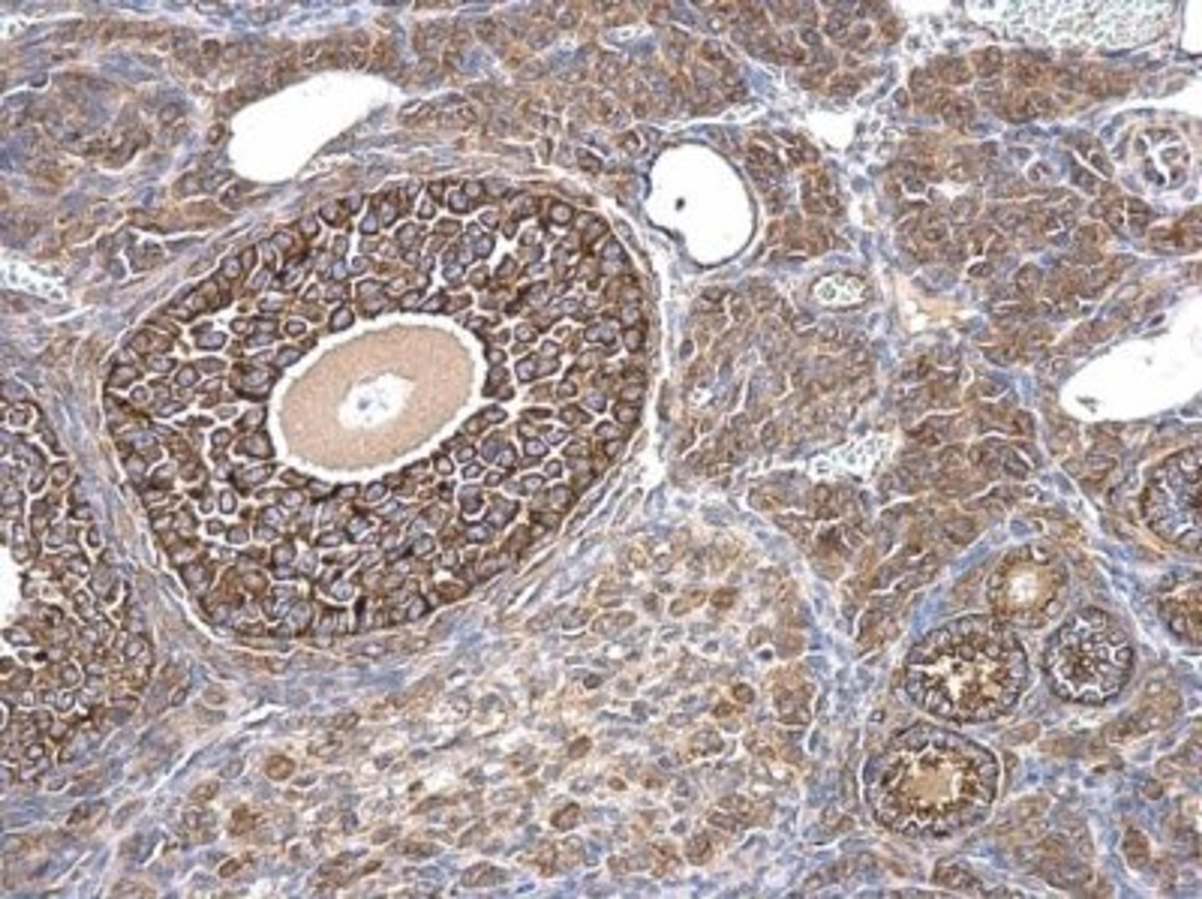 Immunocytochemistry/Immunofluorescence: MIS/AMH Antibody [NBP2-43670] - Analysis of mouse ovary. AMH antibody dilution: 1:500.