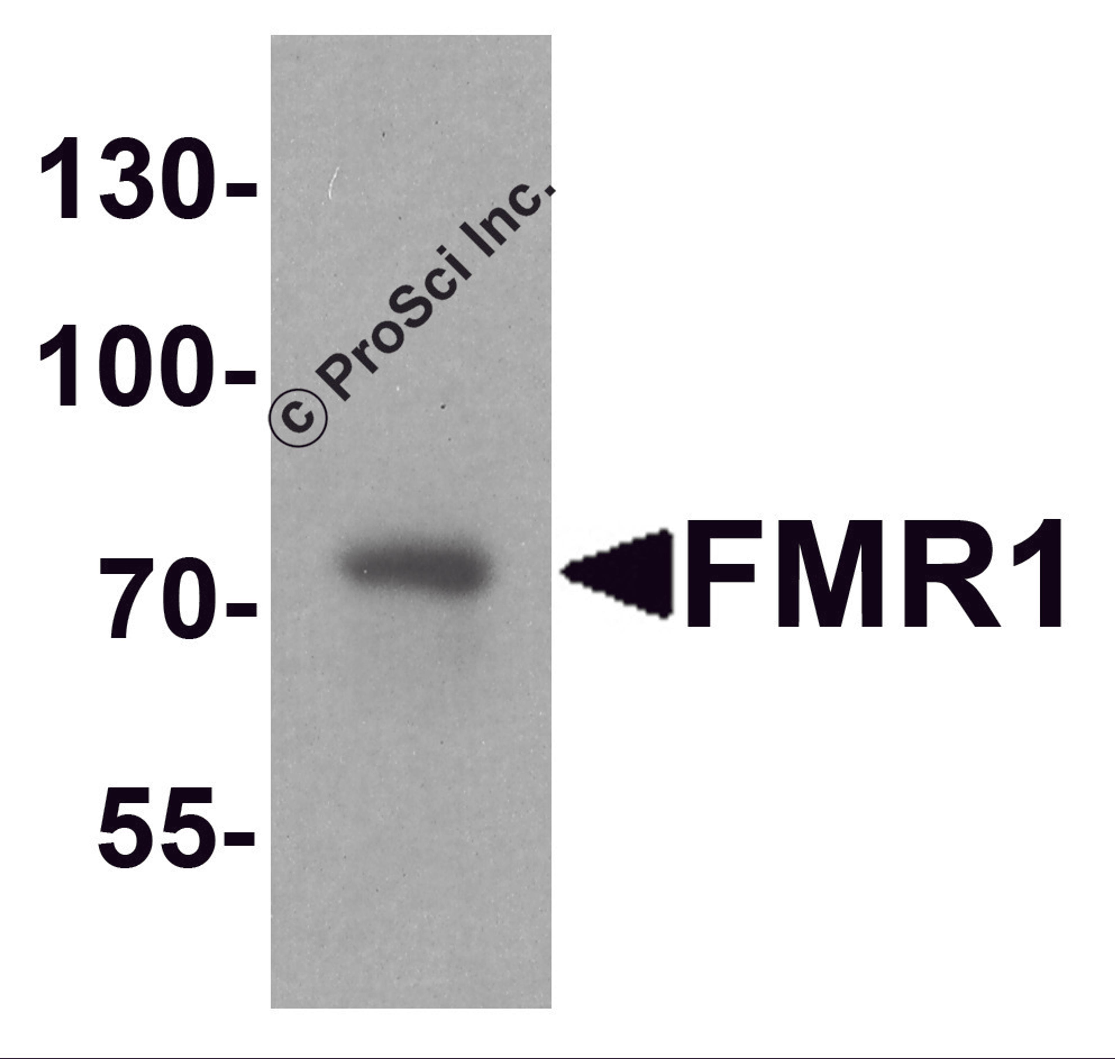 Western blot analysis of FMR1 in rat brain tissue lysate with FMR1 antibody at 1 μg/ml.