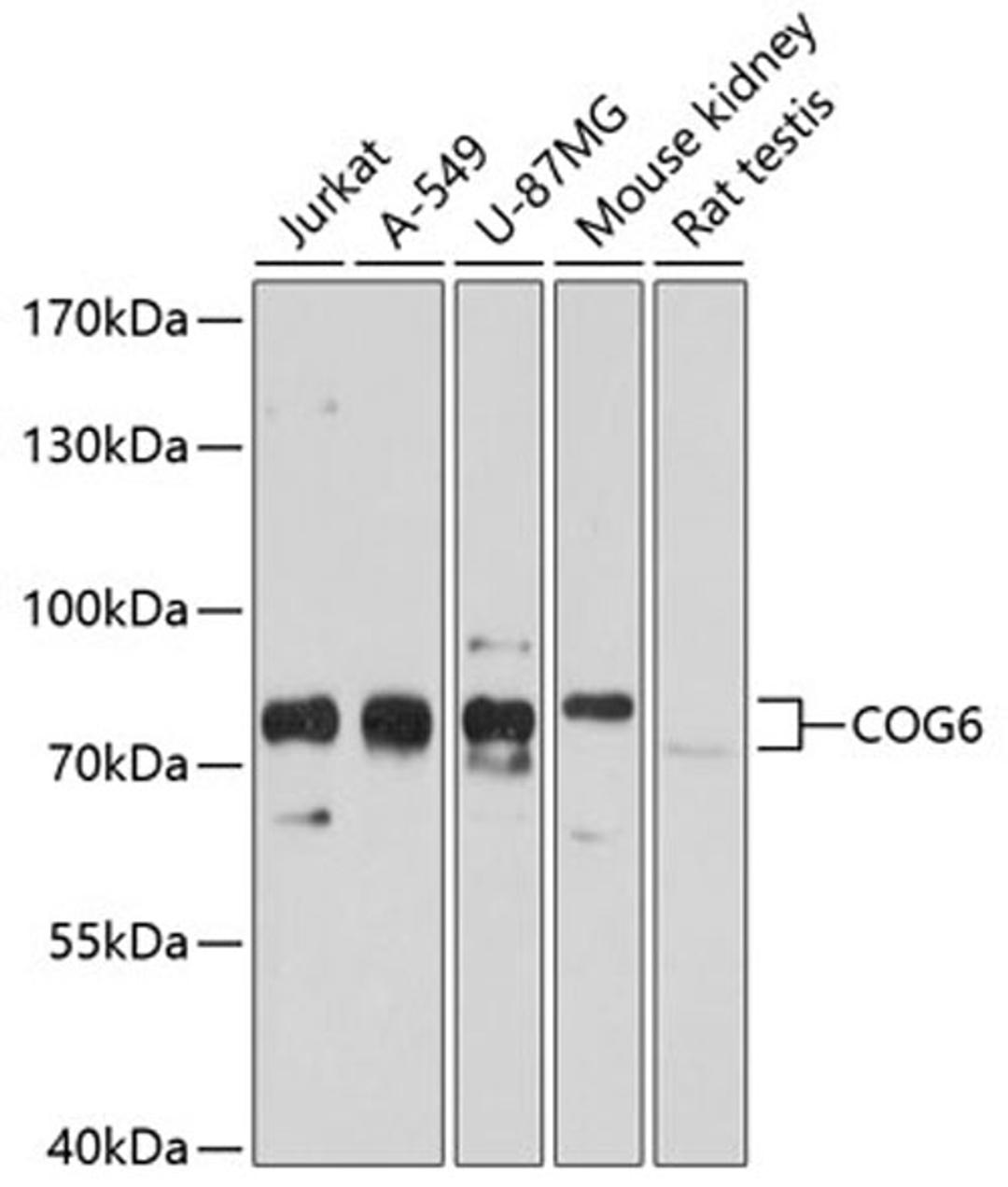 Western blot - COG6 antibody (A10319)