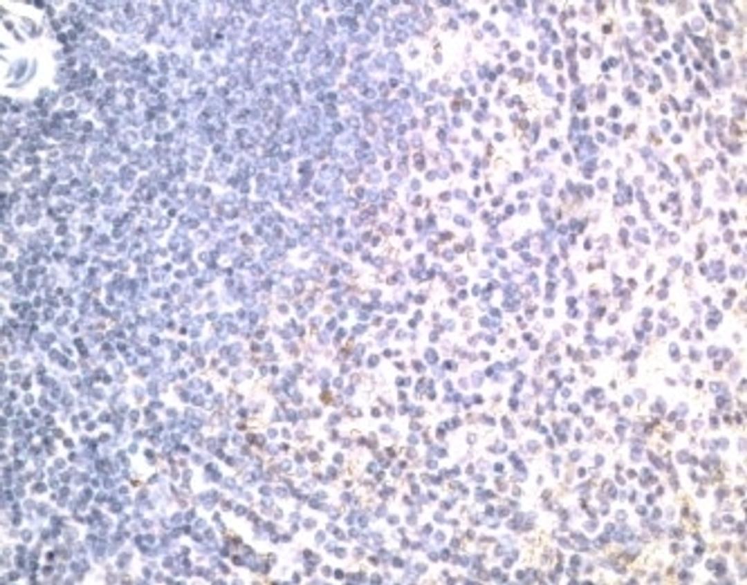 Paraffin embedded human spleen stained with Goat anti human CD262 (AHP1806)