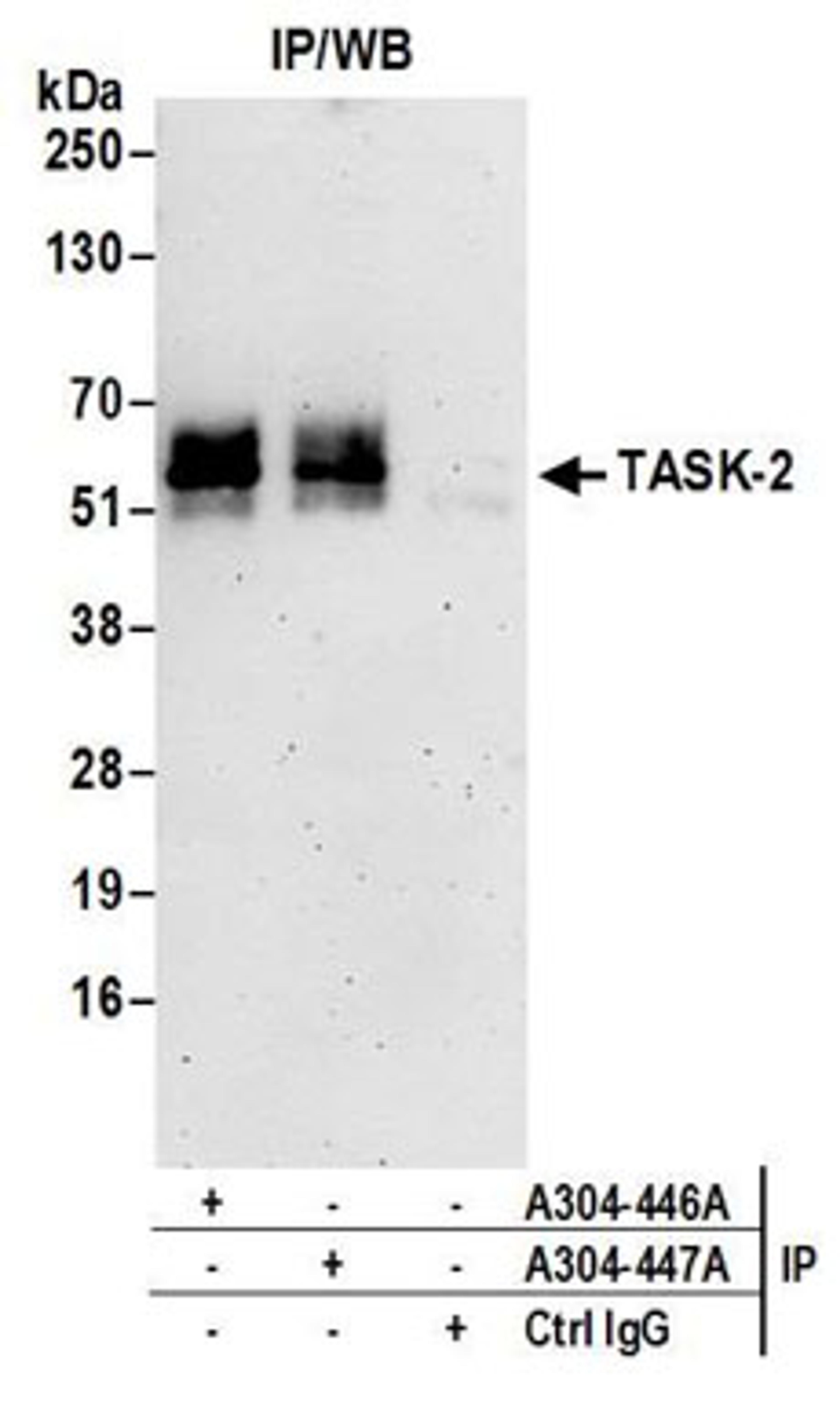 Detection of human TASK-2 by western blot of immunoprecipitates.